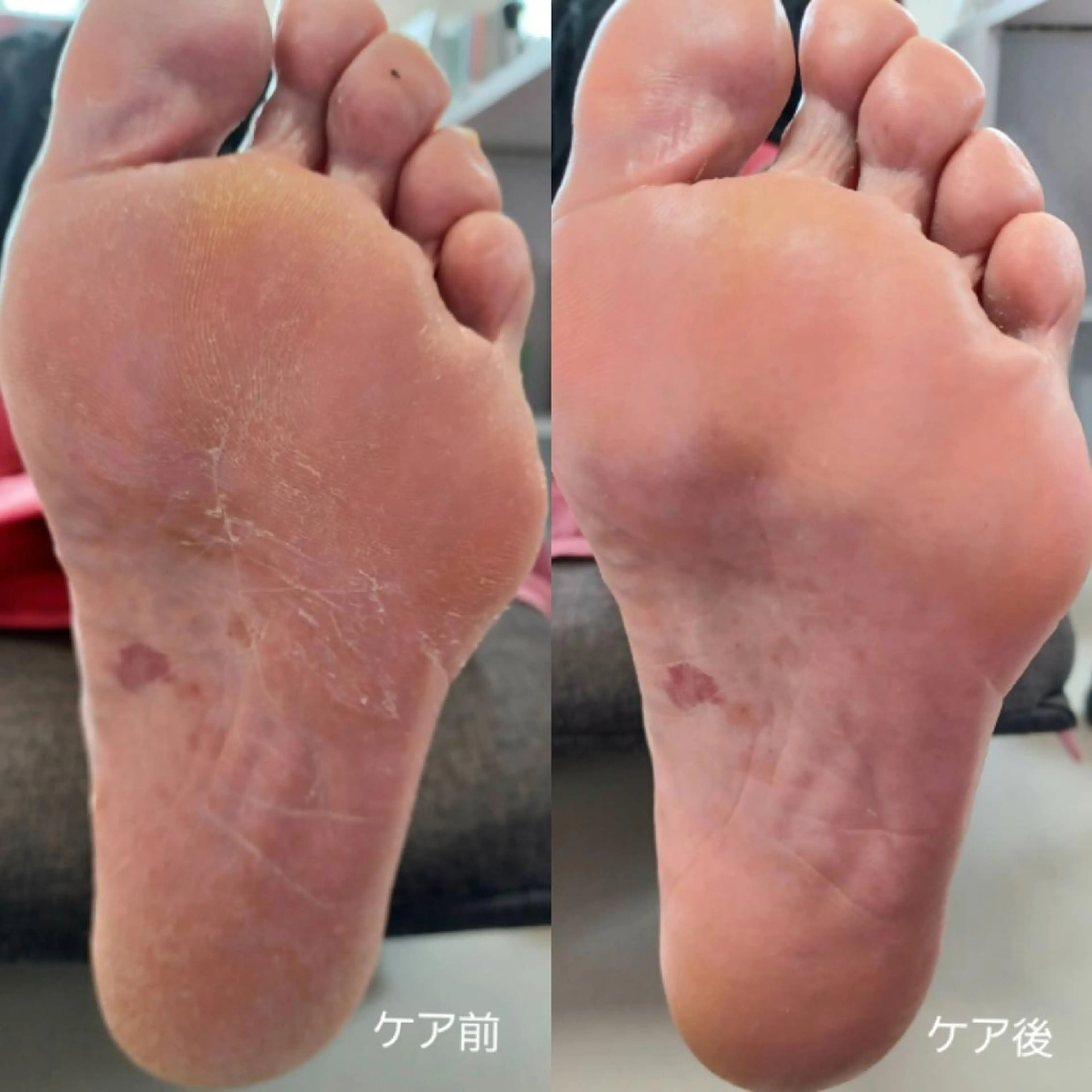 その他(ネイル) Micky nail chikushinoのネイルデザイン