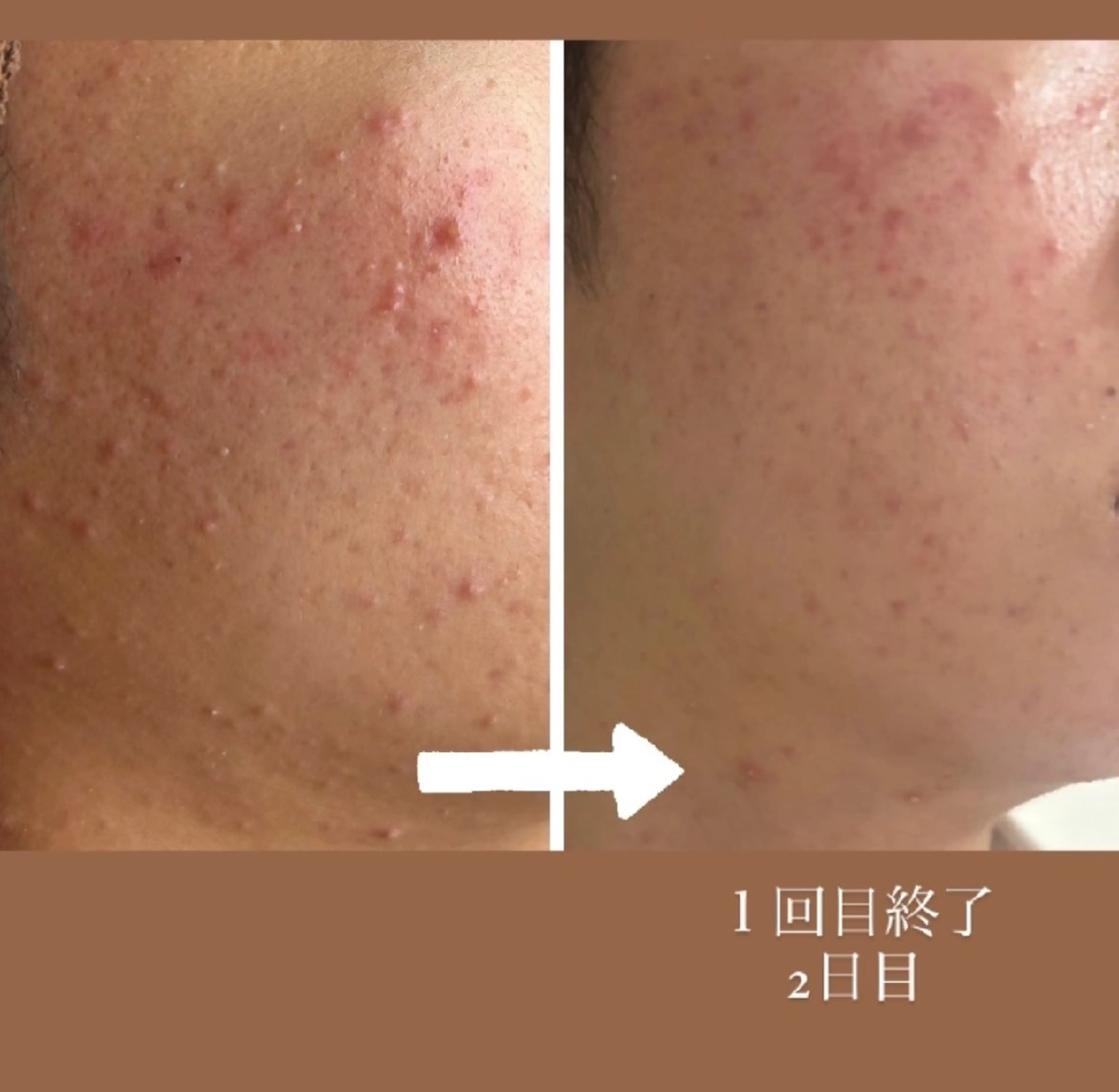 エステ sbeaute所属・sbeaute  エスボーテのエステ・リラクイメージ