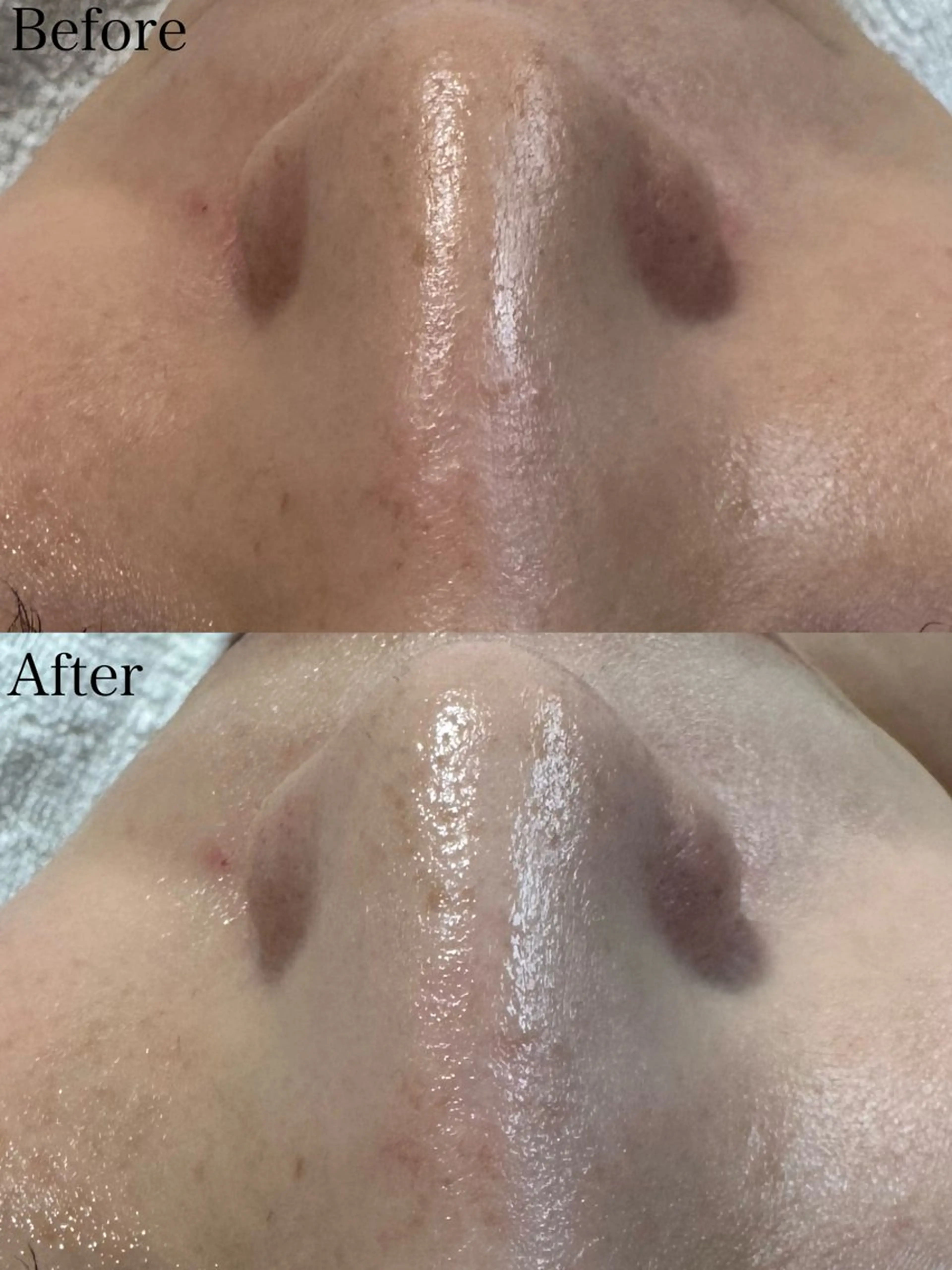 エステ beautysalon LIMOA所属・松本 愛絵理のエステ・リラクイメージ