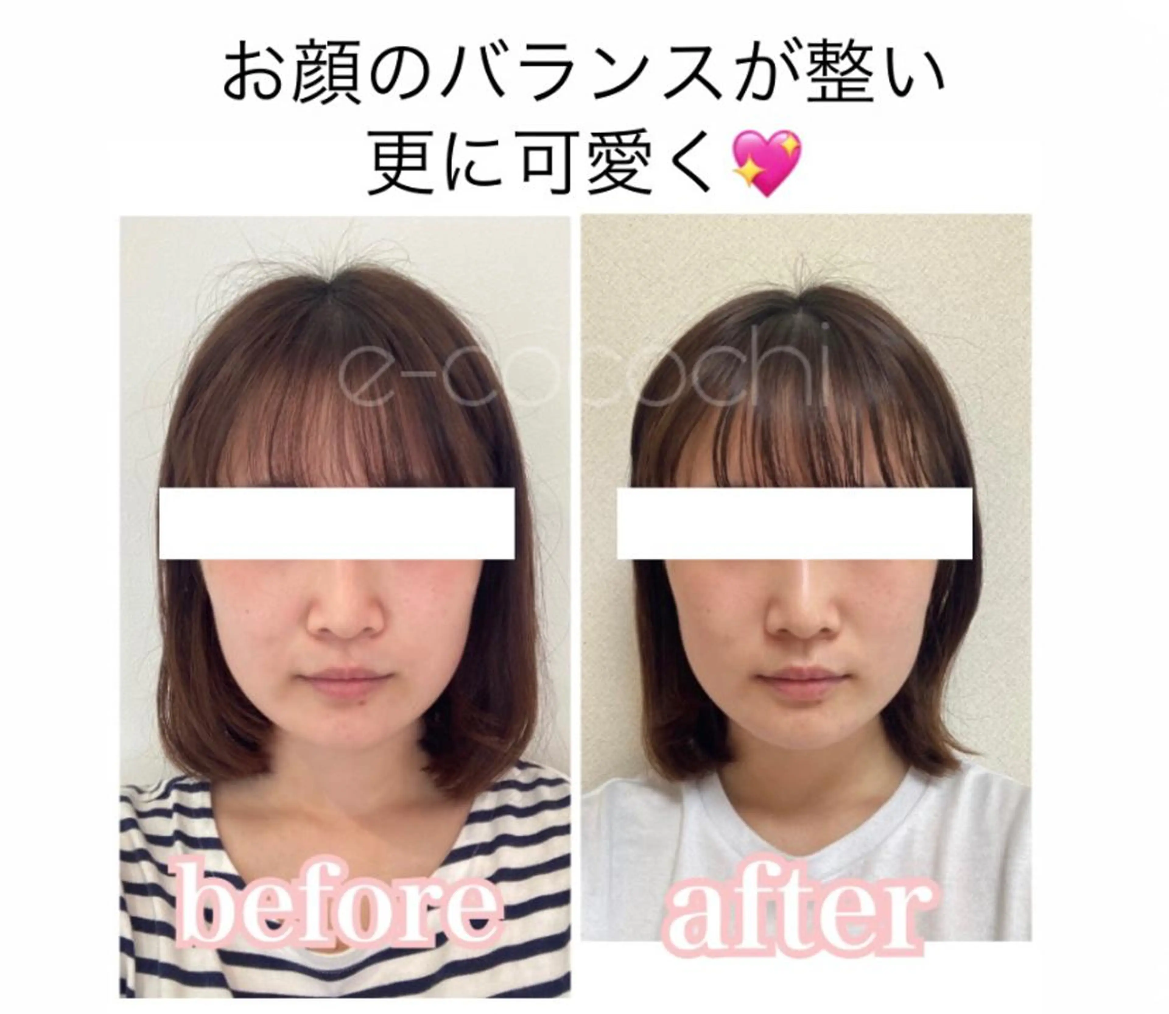 エステ リラク 小顔と ヘッドスパのお店のエステ・リラクイメージ