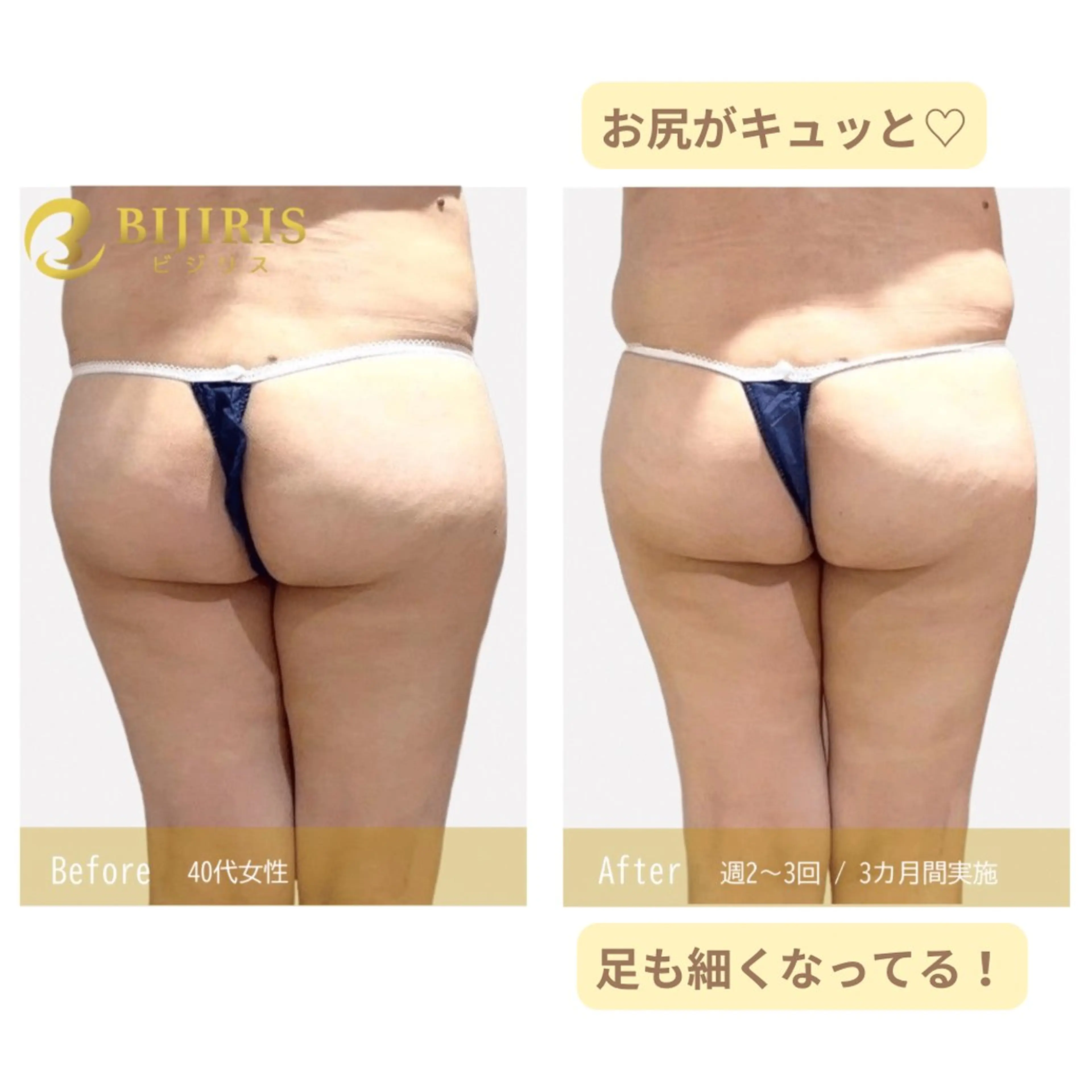 セルフ脱毛/美尻イス キングスサロン熊本のエステ・リラクイメージ