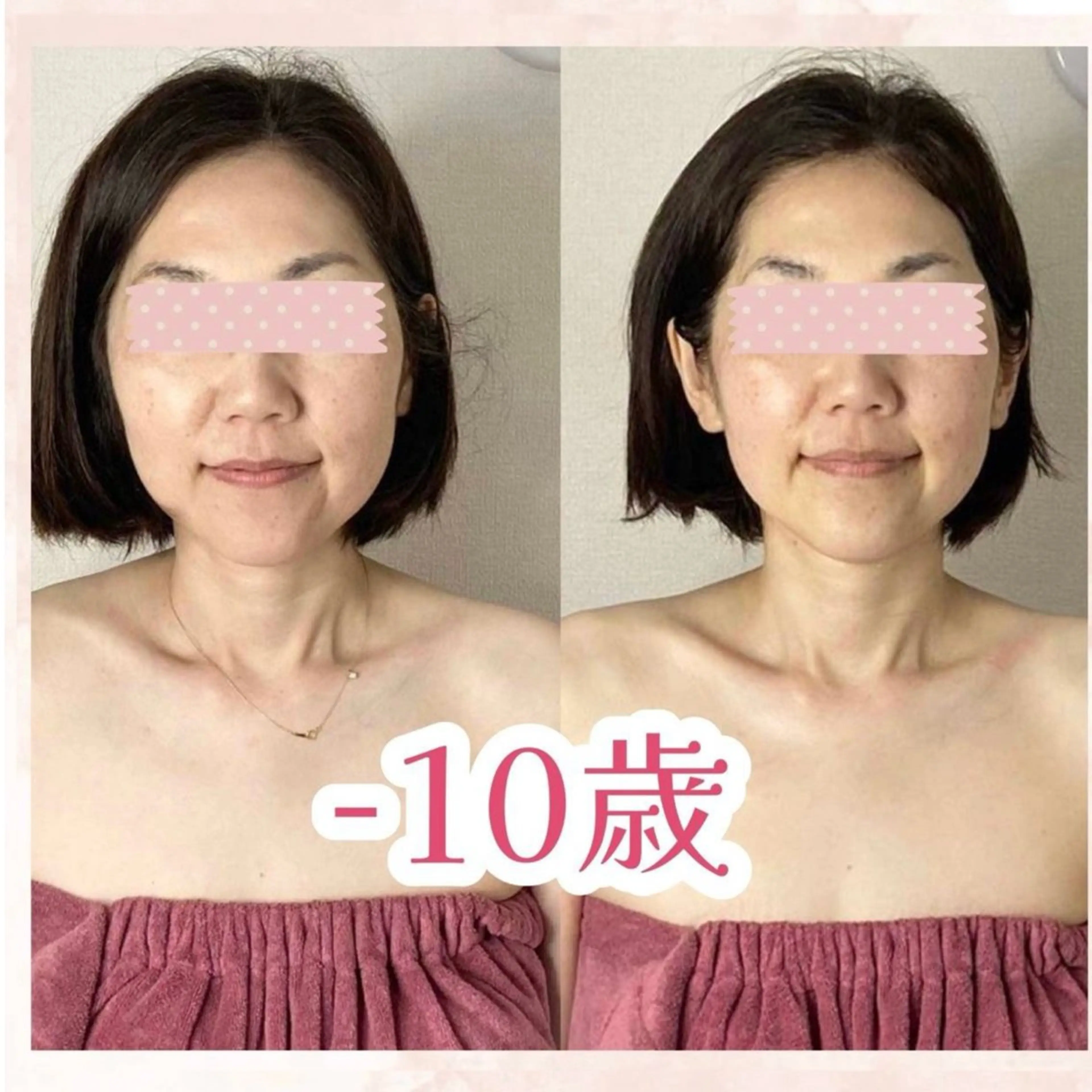 hitohana所属・毛穴/いちご鼻/小顔 /hitohanaのエステ・リラクイメージ