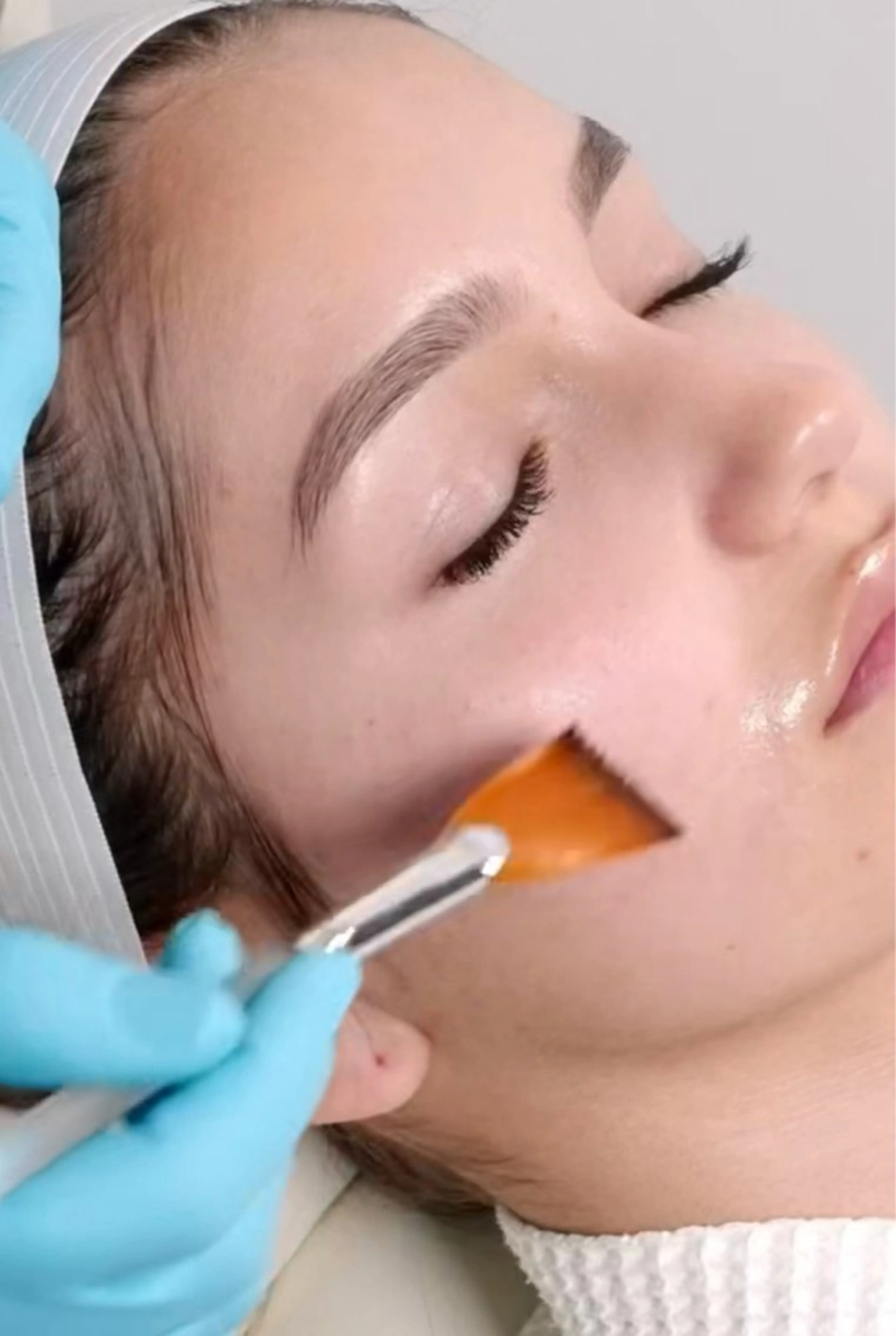 ⚪️皮膚科医監修⚪️瞬時につるつる素肌👶🏻⚪️乳酸ピーリングの写真