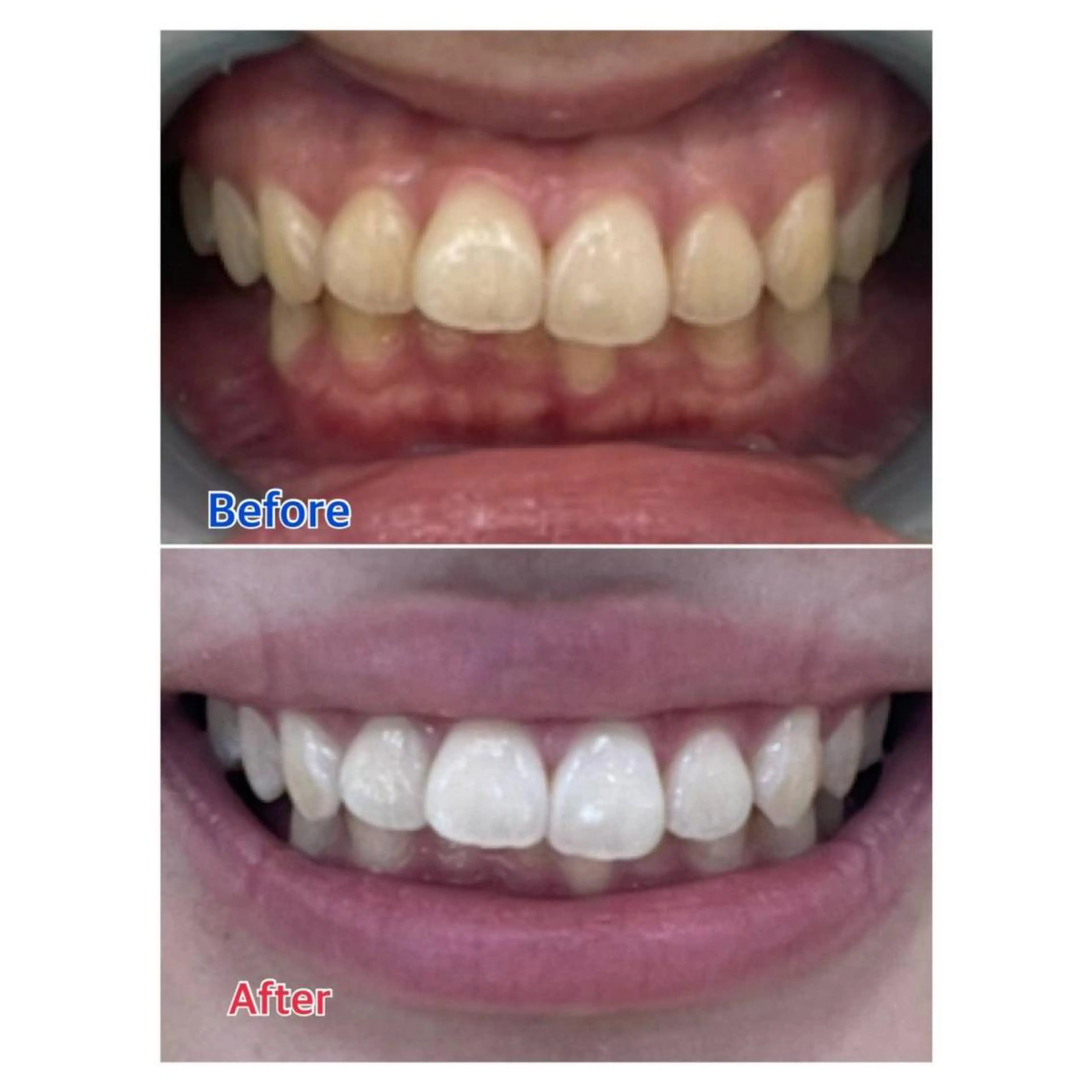 MBEAUTYSALON 千葉店・京成大久保所属・Melty 輝のその他イメージ