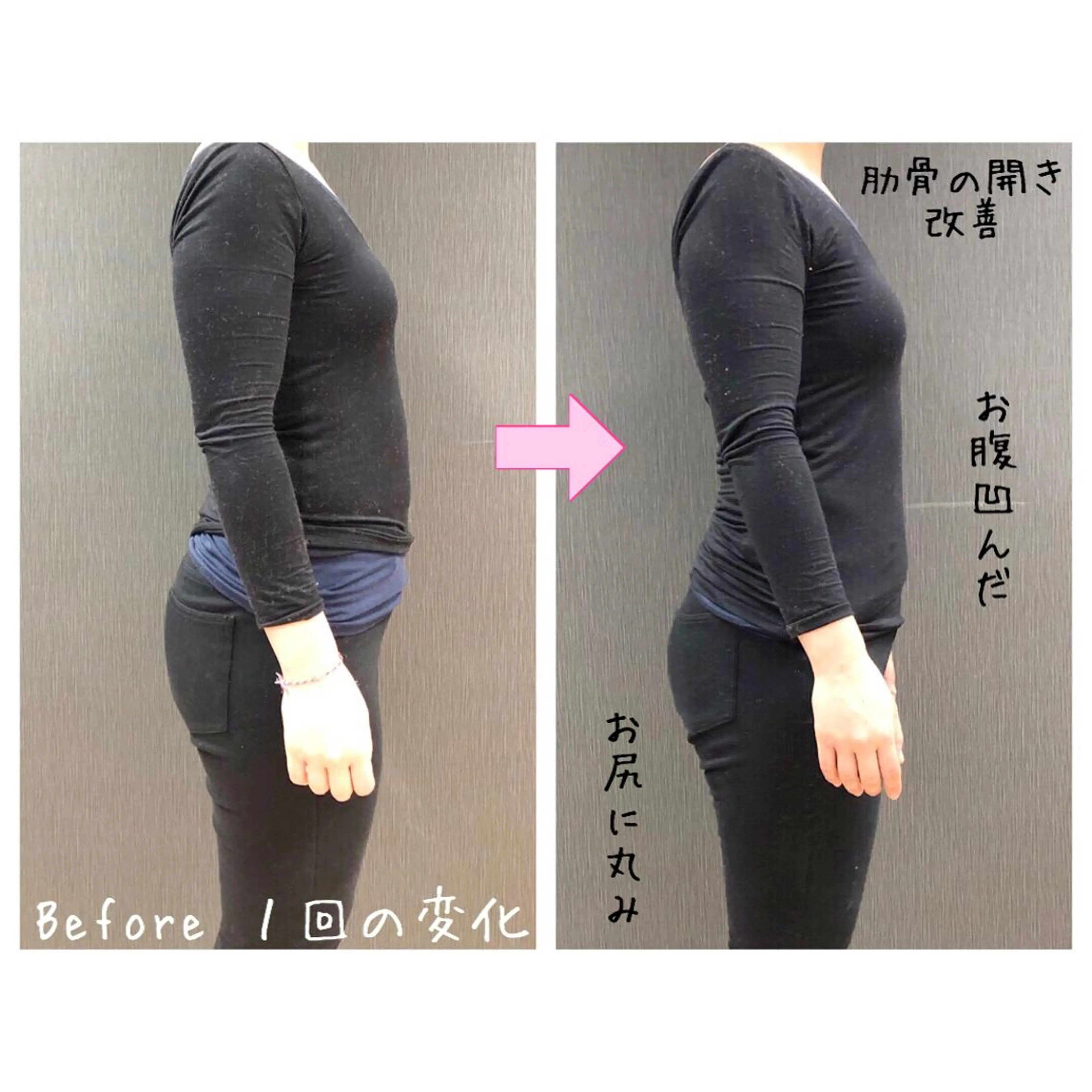 小顔モニター 募集のエステ・リラクイメージ