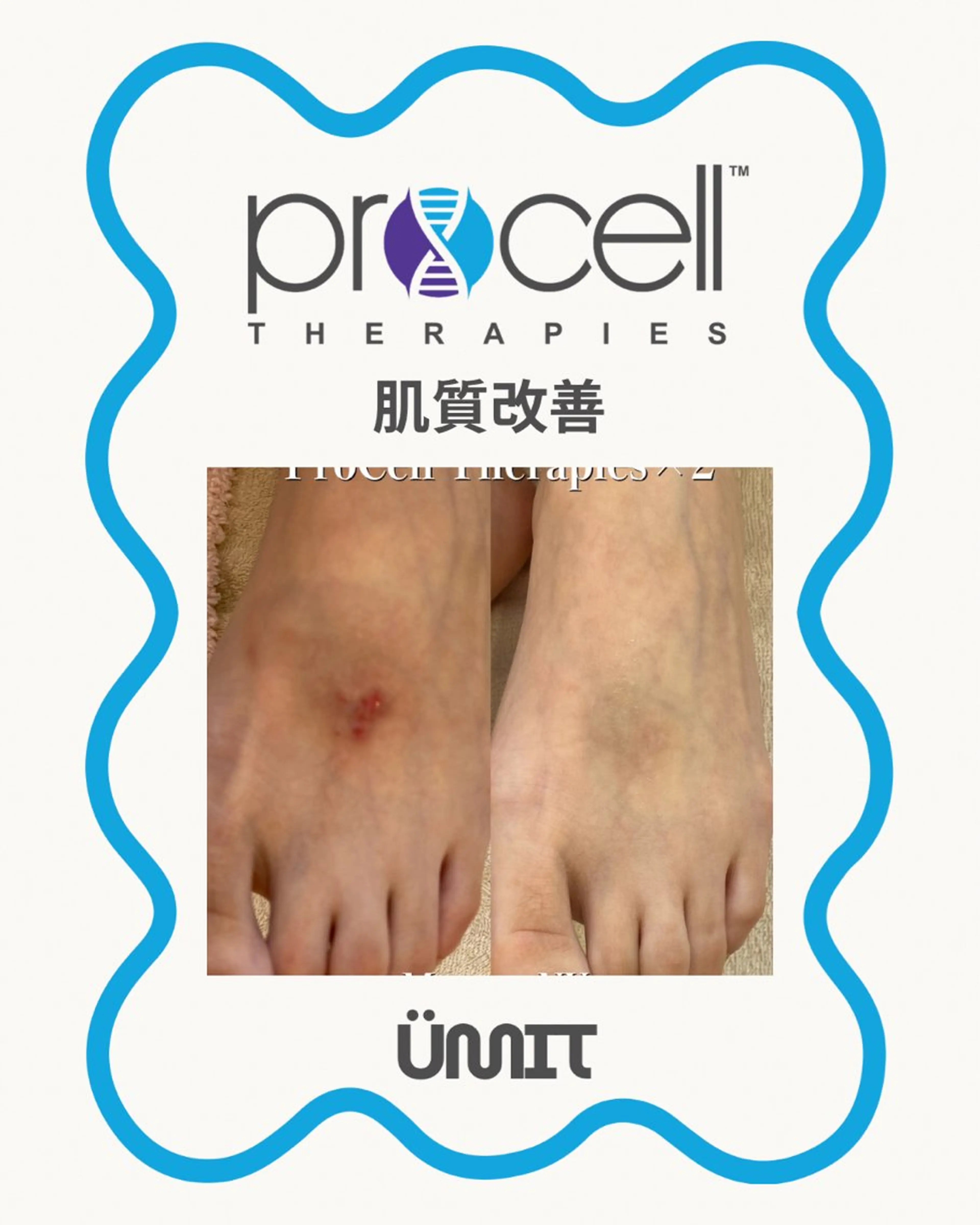 エステ Ümit（ユミト） プロセルセラピーズのヘアスタイル