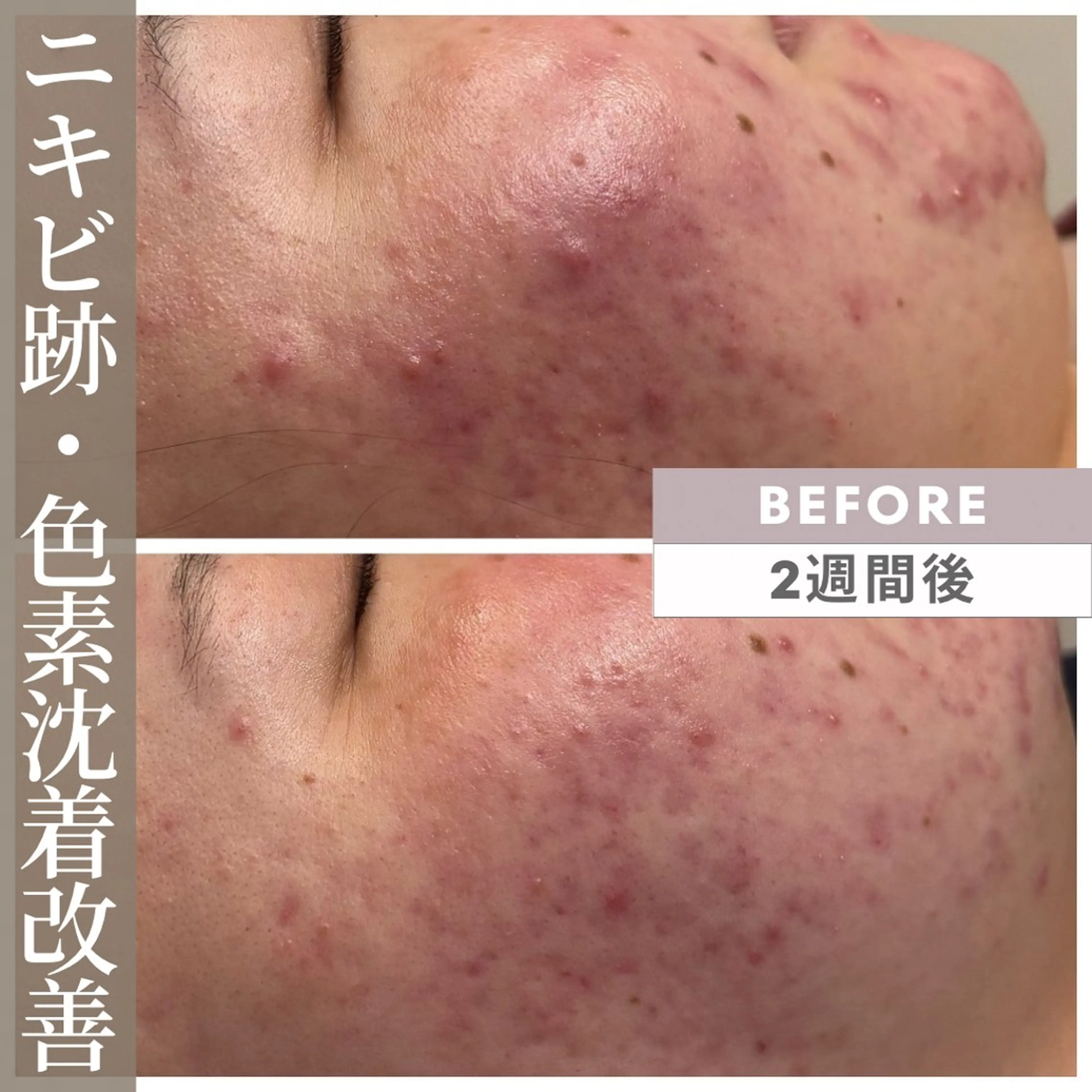 エステ 小顔矯正専門店 【RED】池田のエステ・リラクイメージ