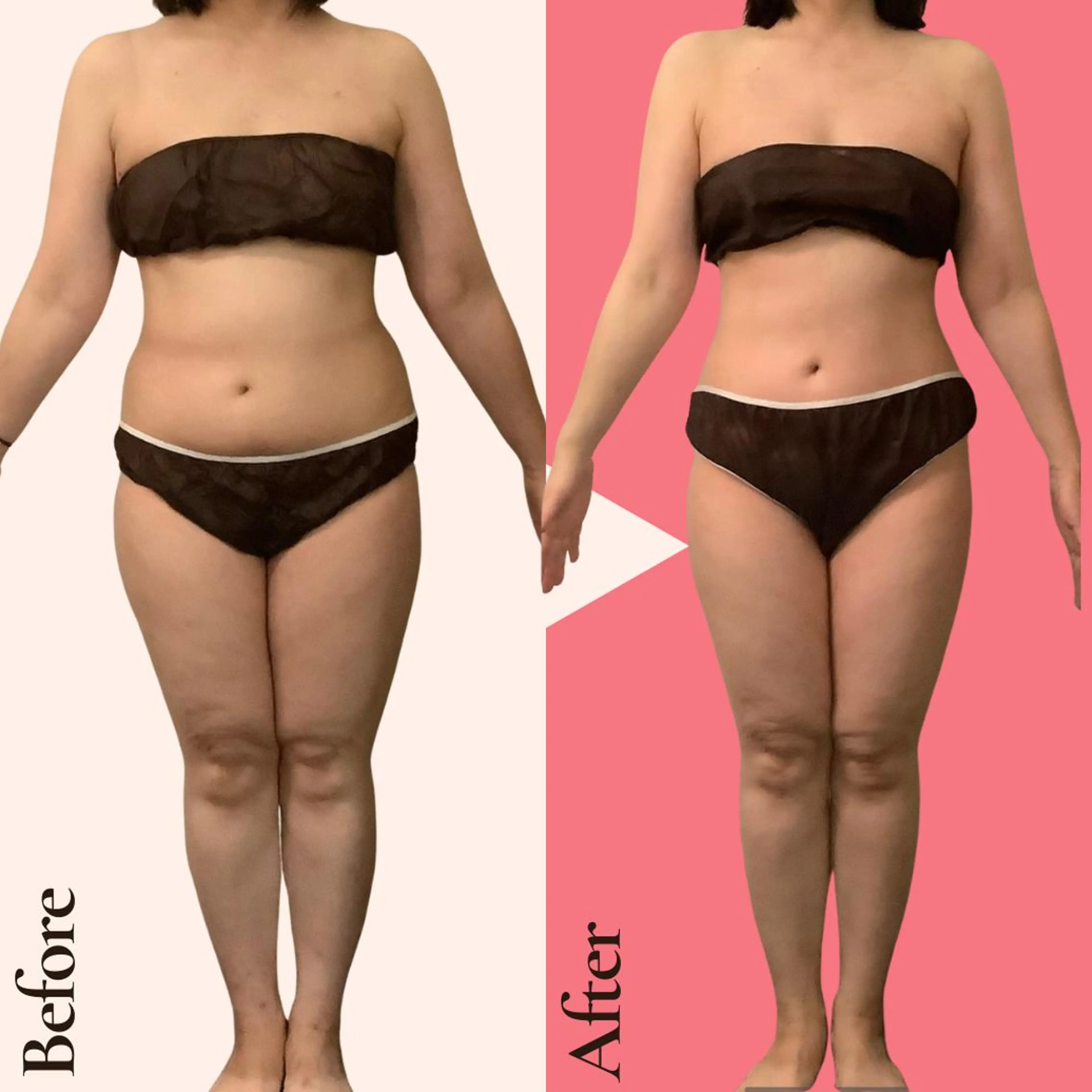 エステ 痩身ダイエット専門店 プレシャスのエステ・リラクイメージ