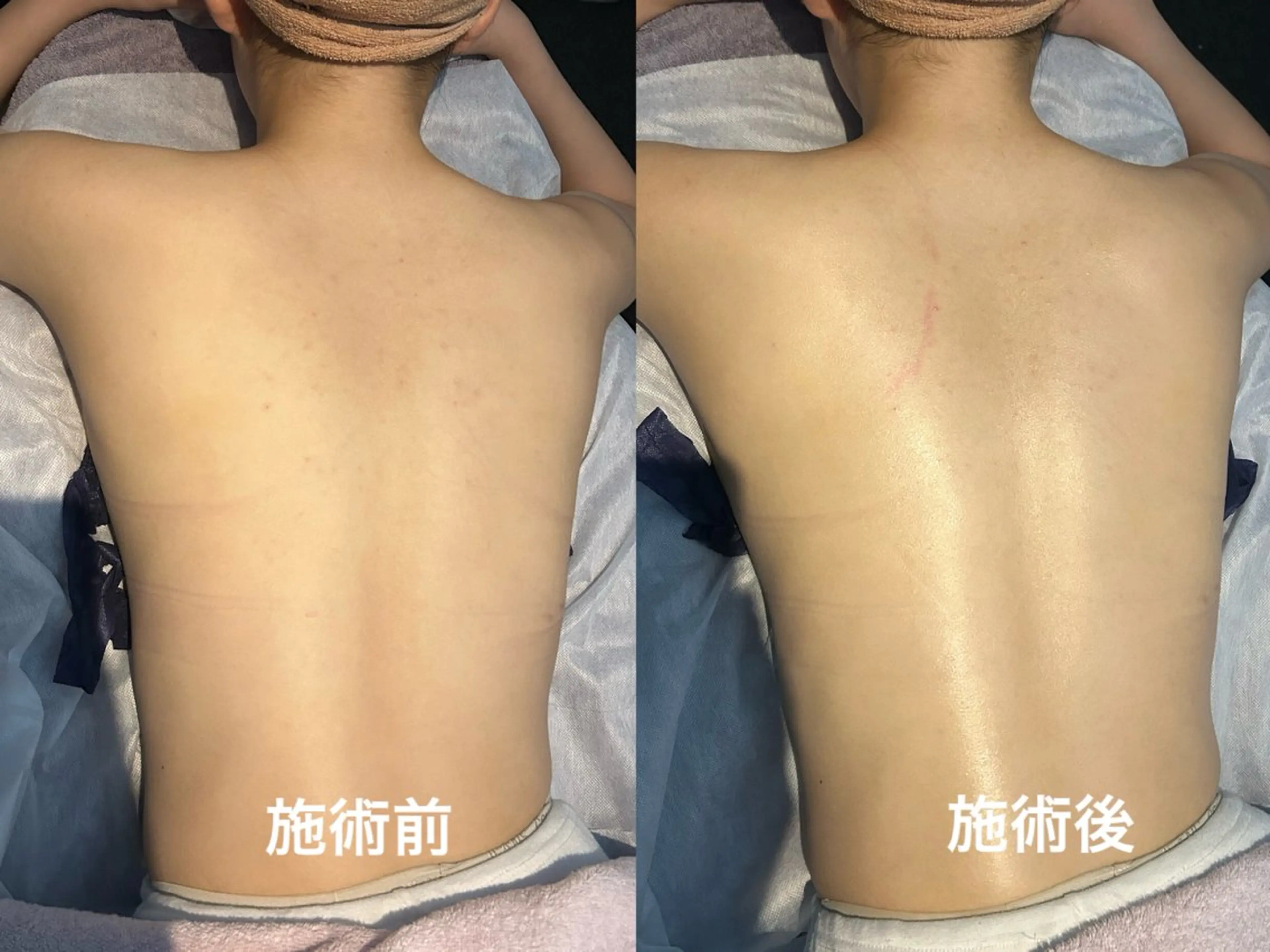 エステ 長谷川 望美のエステ・リラクイメージ