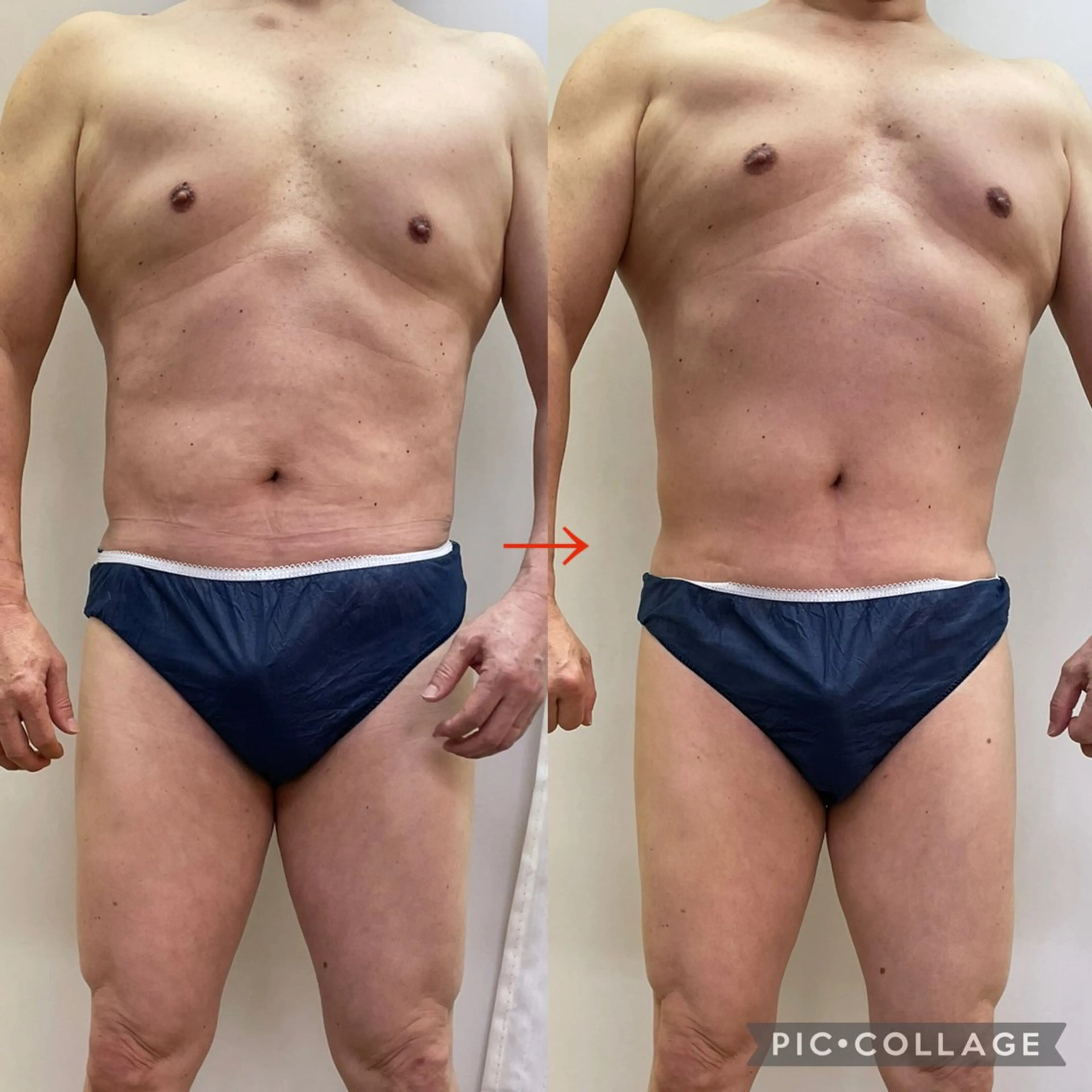 メンズ エステ トータルビューティーサロン LilyRose所属・エステサロン LilyRoseのエステ・リラクイメージ