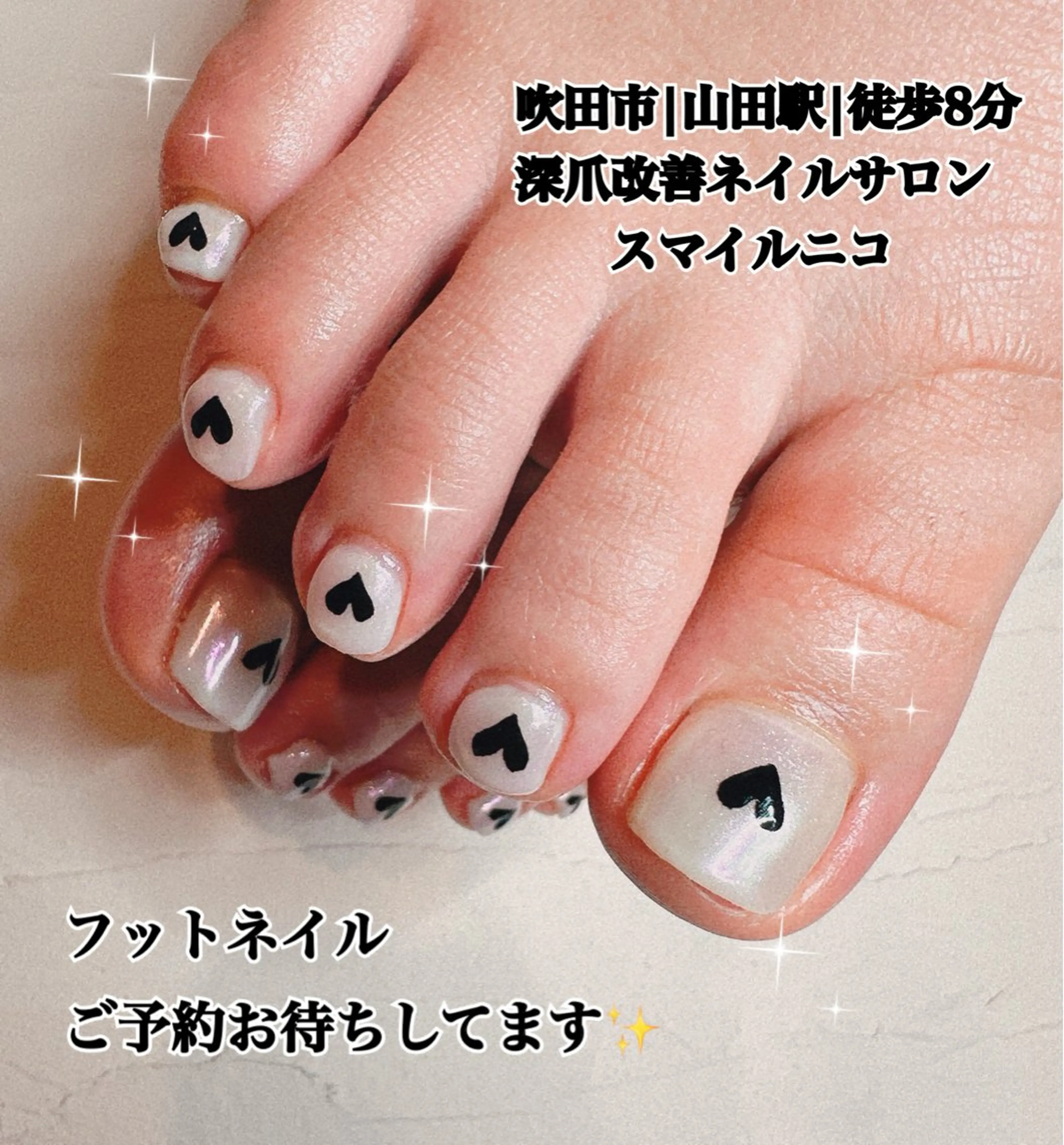 【フット深爪矯正】長さ出しあり/ワンカラー/オフ無しの写真