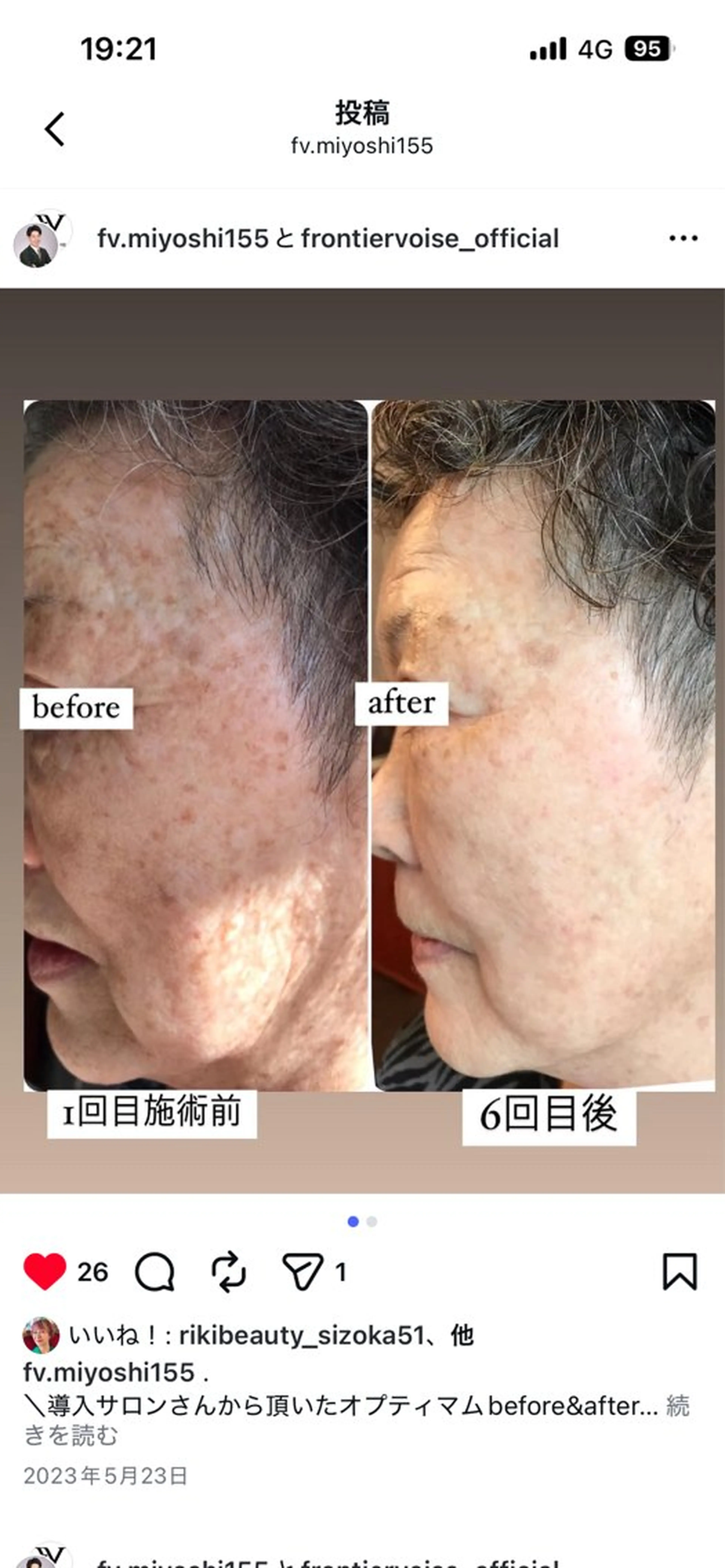 エステ スリーエスプラス内　美肌サロンEme所属・希映 -kieのエステ・リラクイメージ