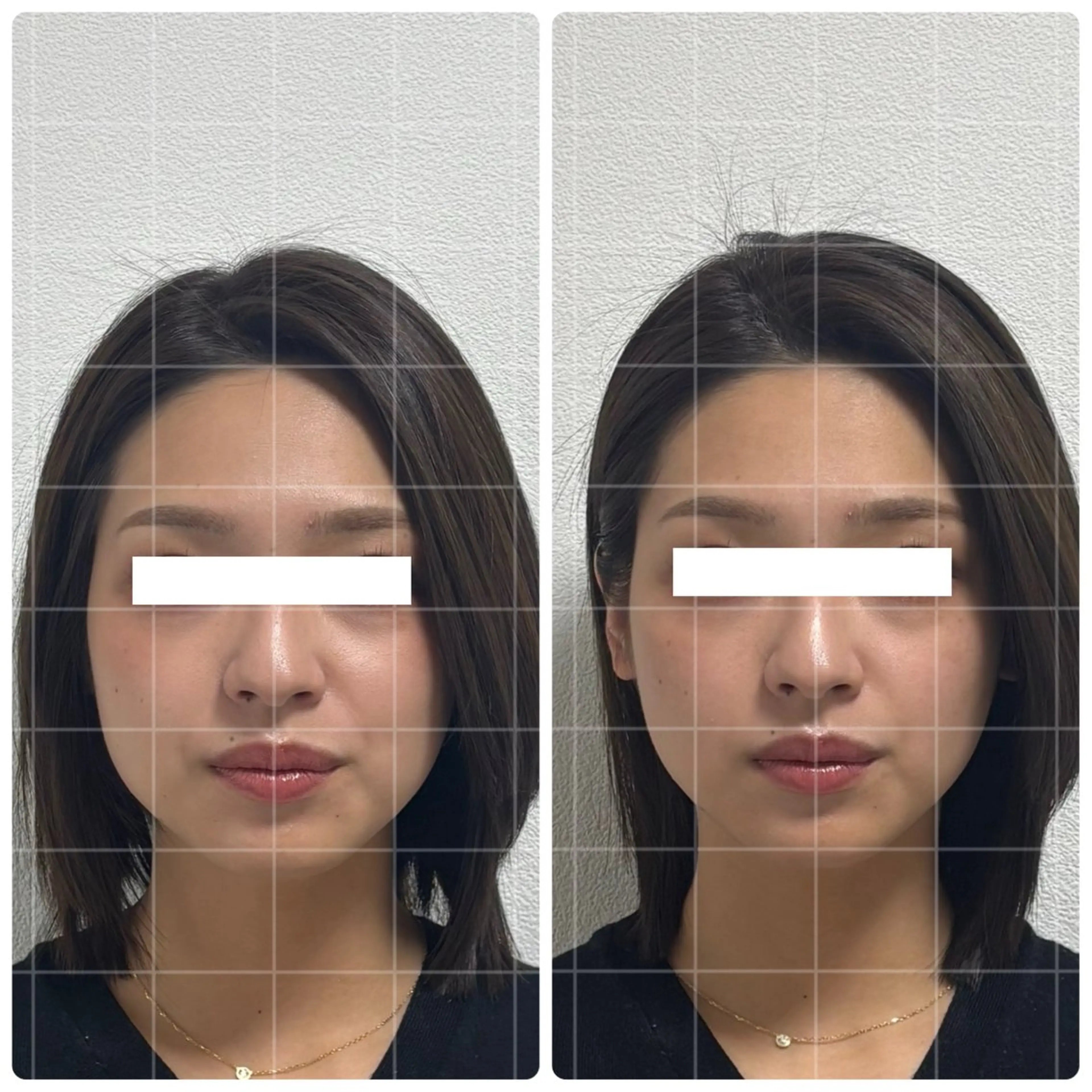 くつろぎ小顔サロン Lu mellow所属・片山けいこ｜ 美人顔創りの専門家のエステ・リラクイメージ