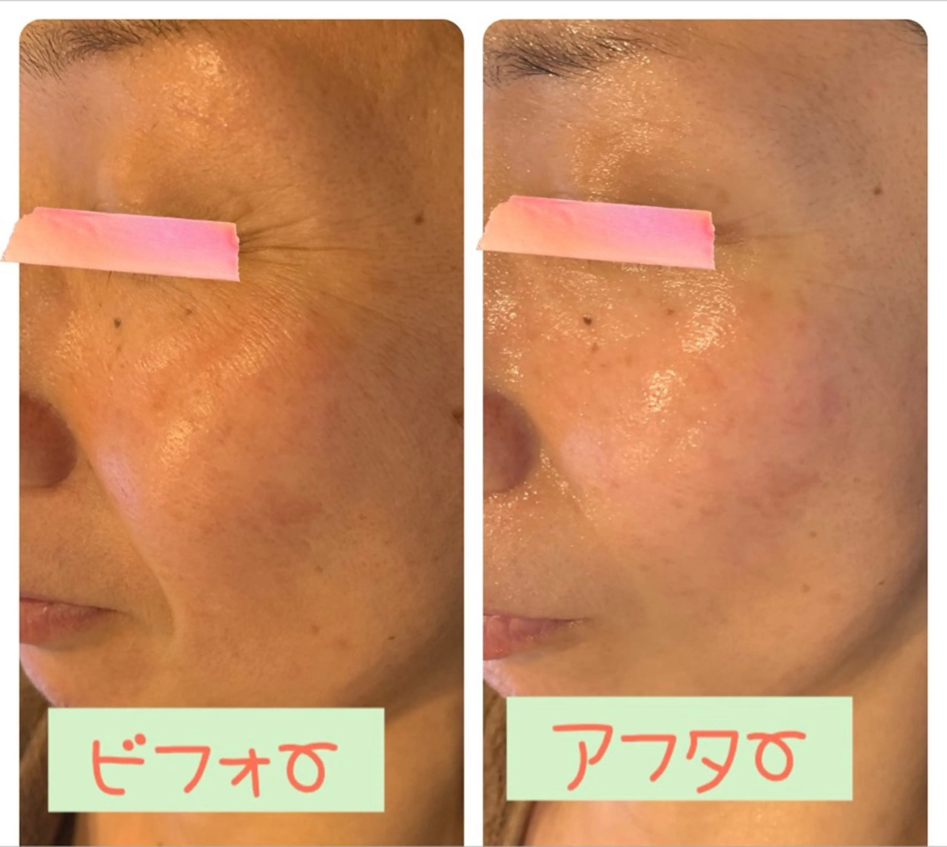 キッズ エステ リラク Pole Poleのエステ・リラクイメージ