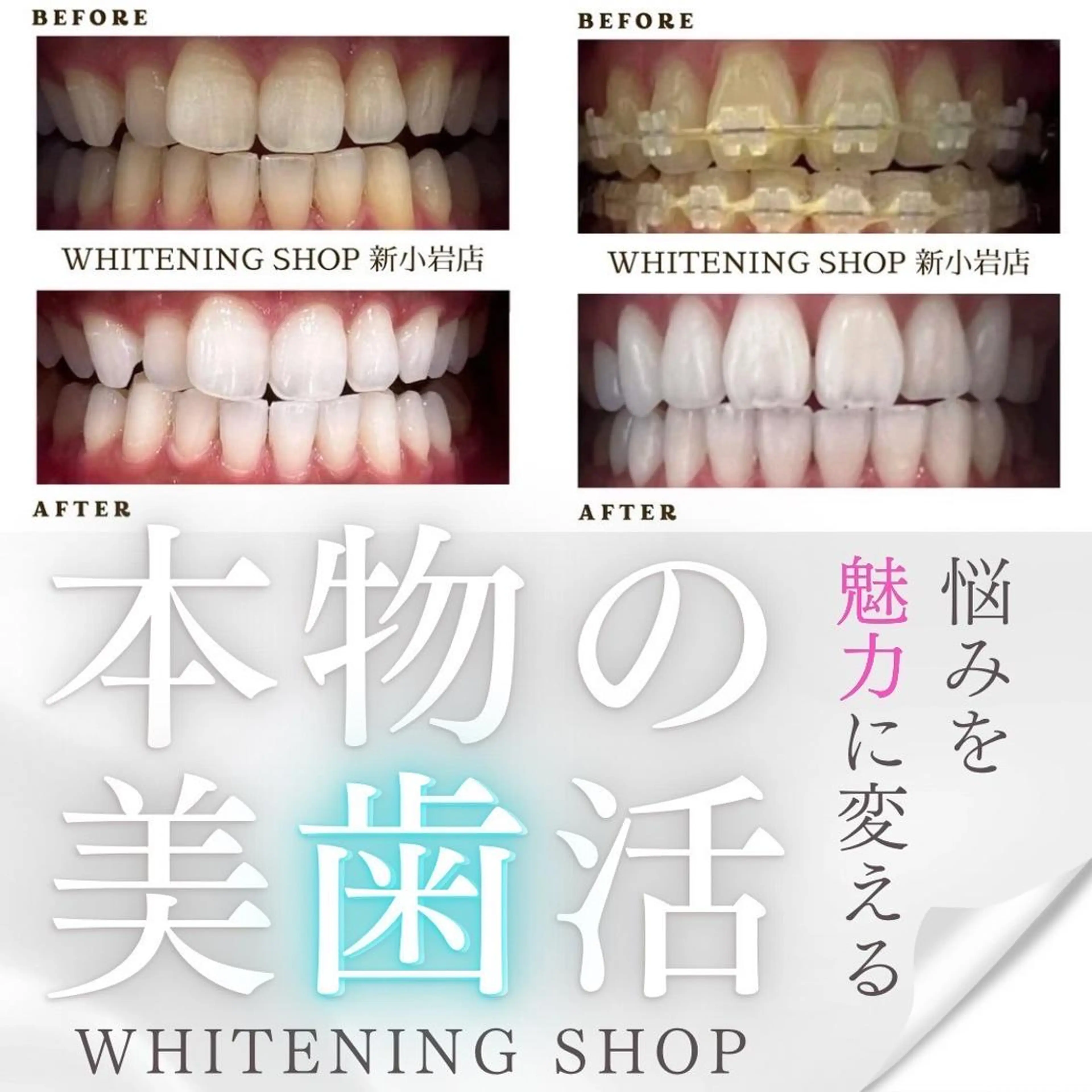 メンズ その他 ホワイトニング ショップ新小岩店のその他イメージ