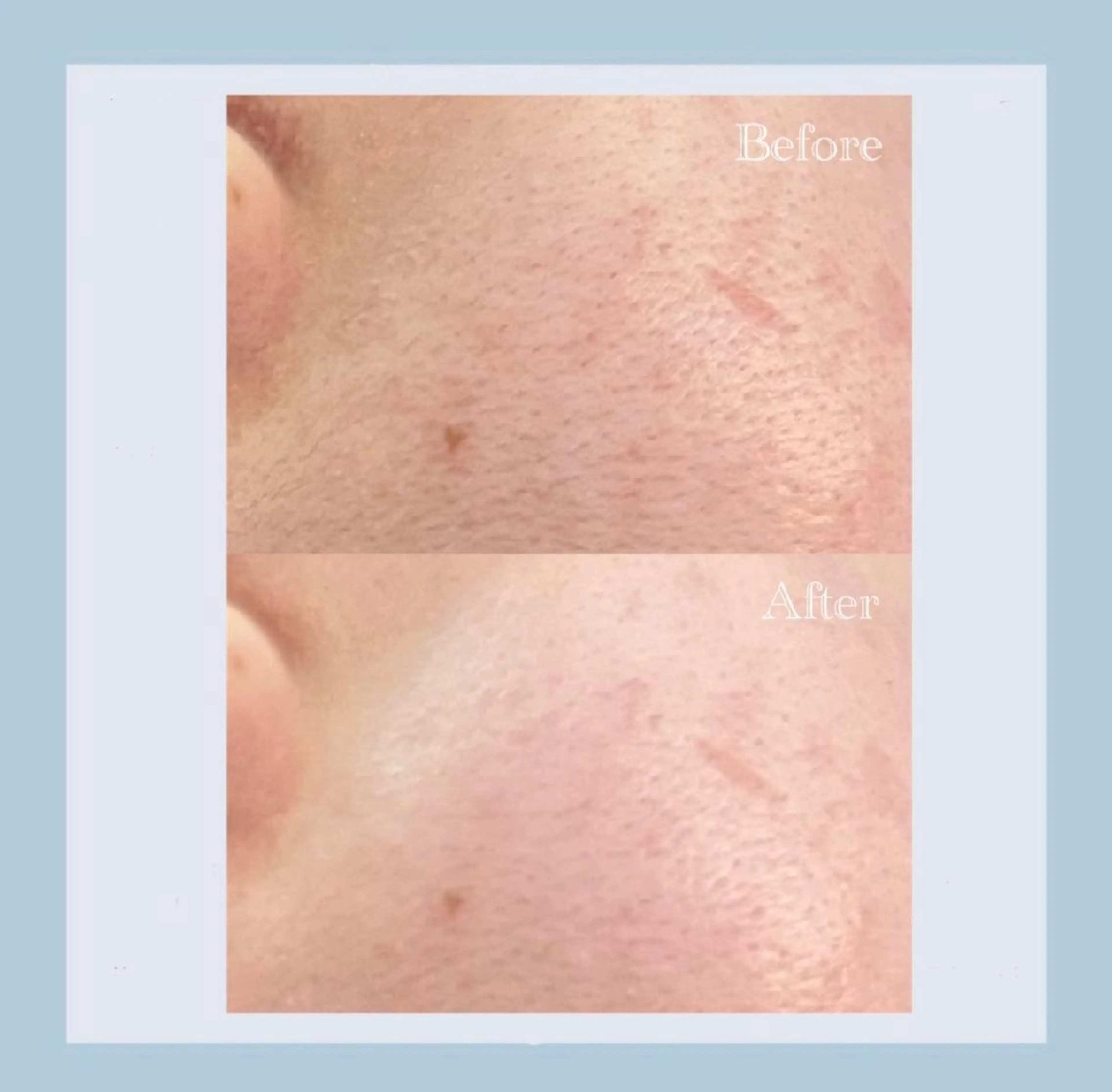 エステ プライベートサロンシャルム所属・プライベートサロン シャルムのその他イメージ