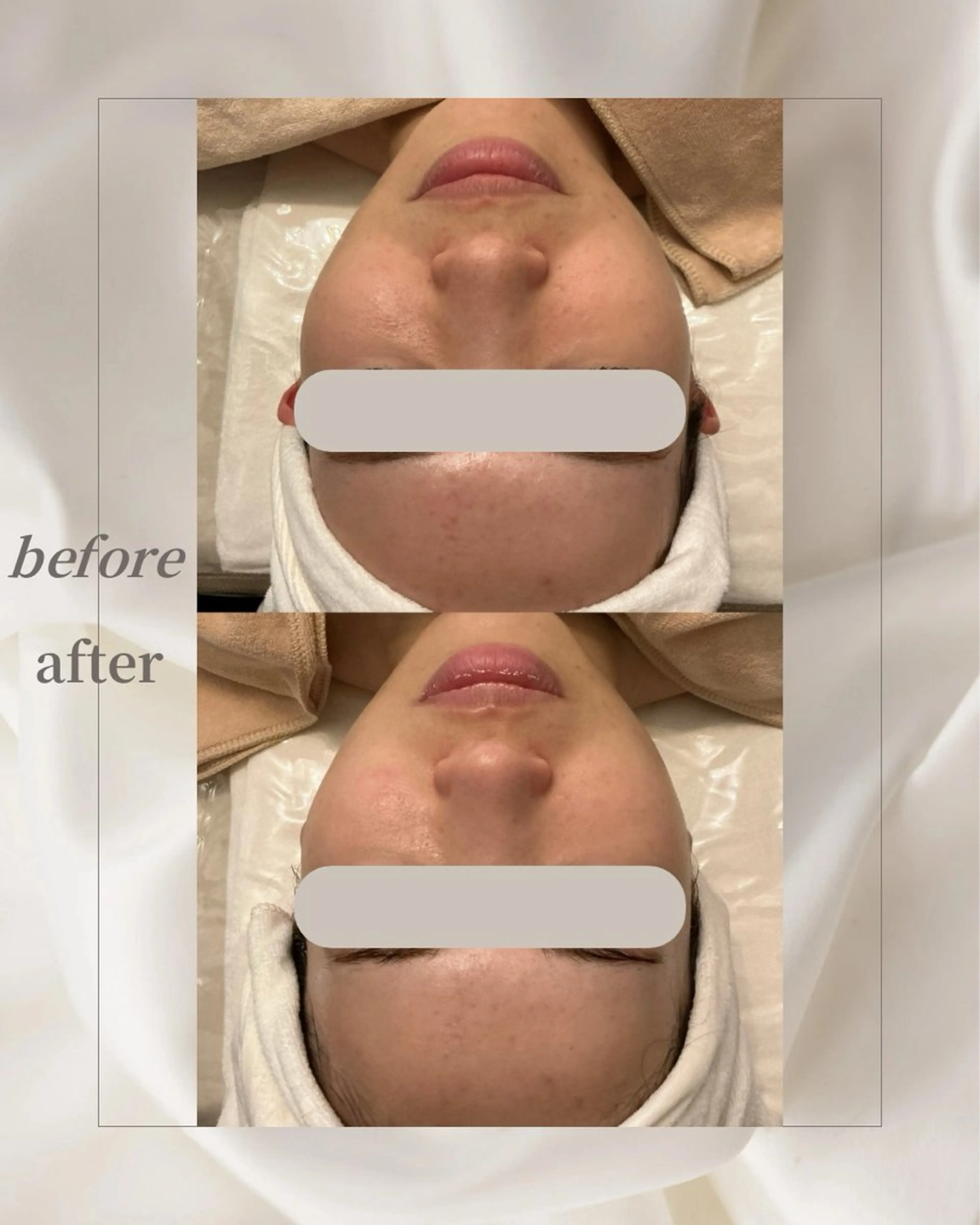 【人気No. 1 ✨】頭からつま先まで整う　　　　　　　　　　　 【フェイシャルフルコース】の写真