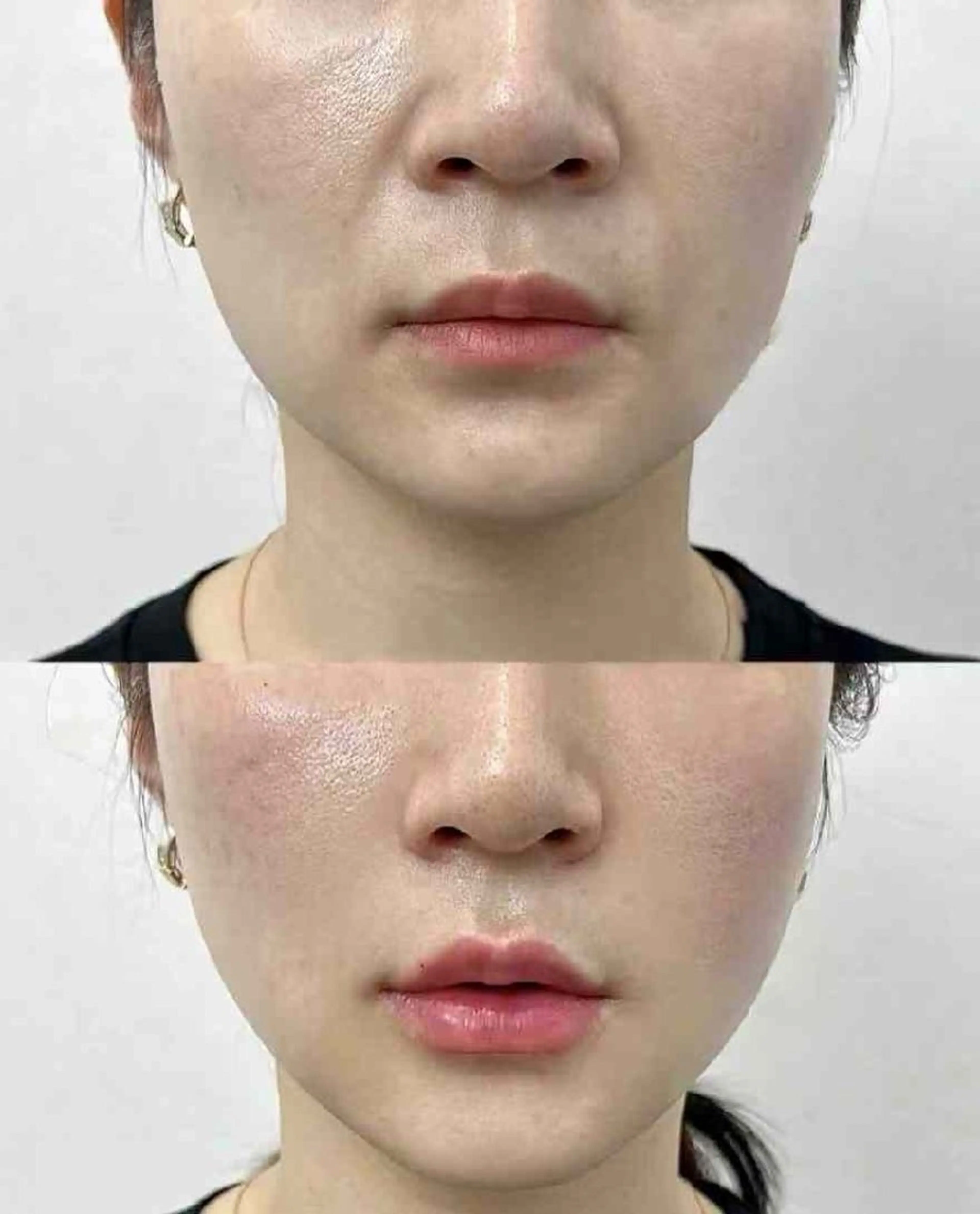 パーマ aliaハイフ&水光ジェットサロン所属・aliaハーブ水光店 エステティシャン募集のエステ・リラクイメージ