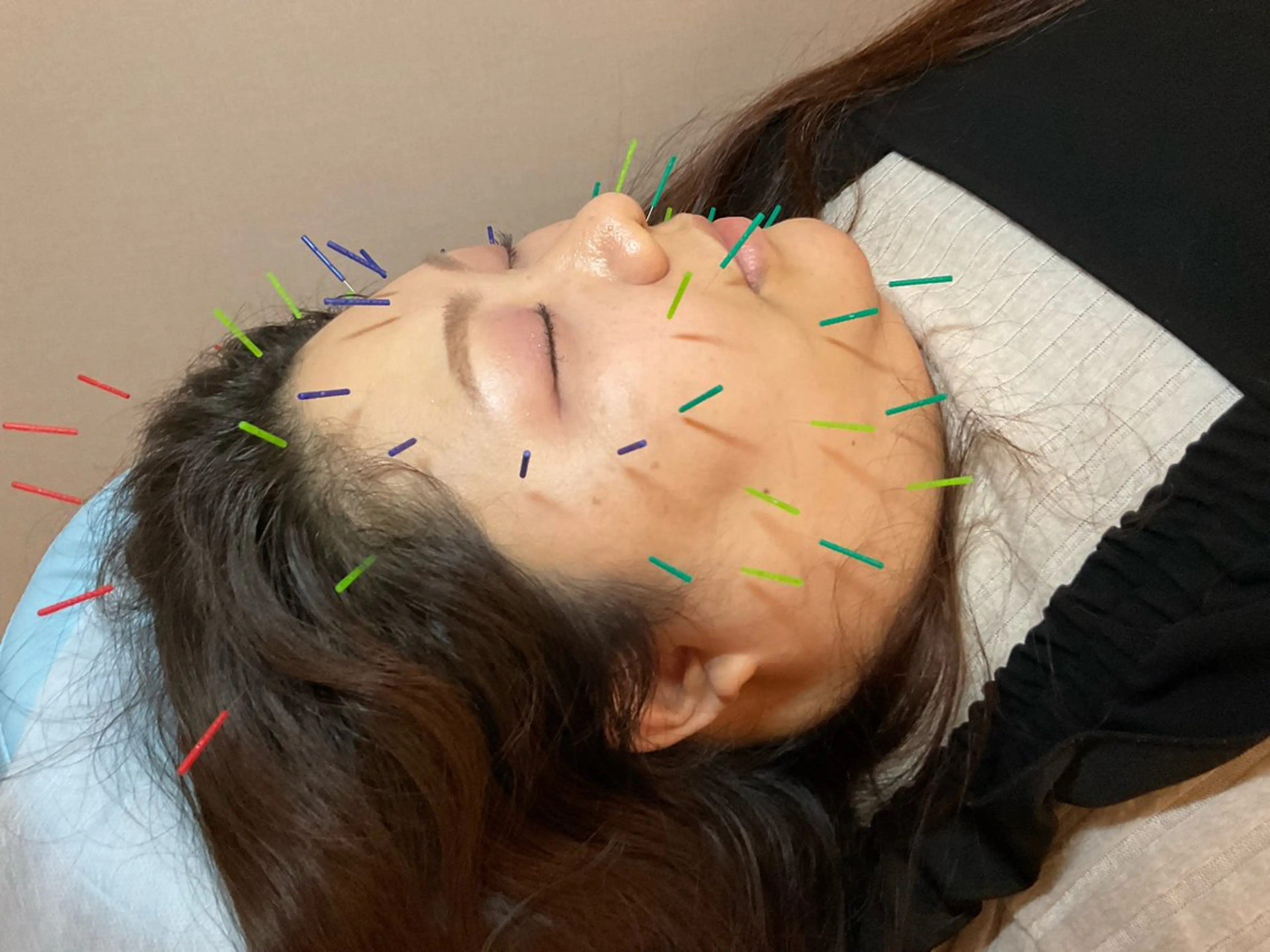 エステ リラク けい整骨院・鍼灸院所属・けい整骨院 鍼灸院のその他イメージ