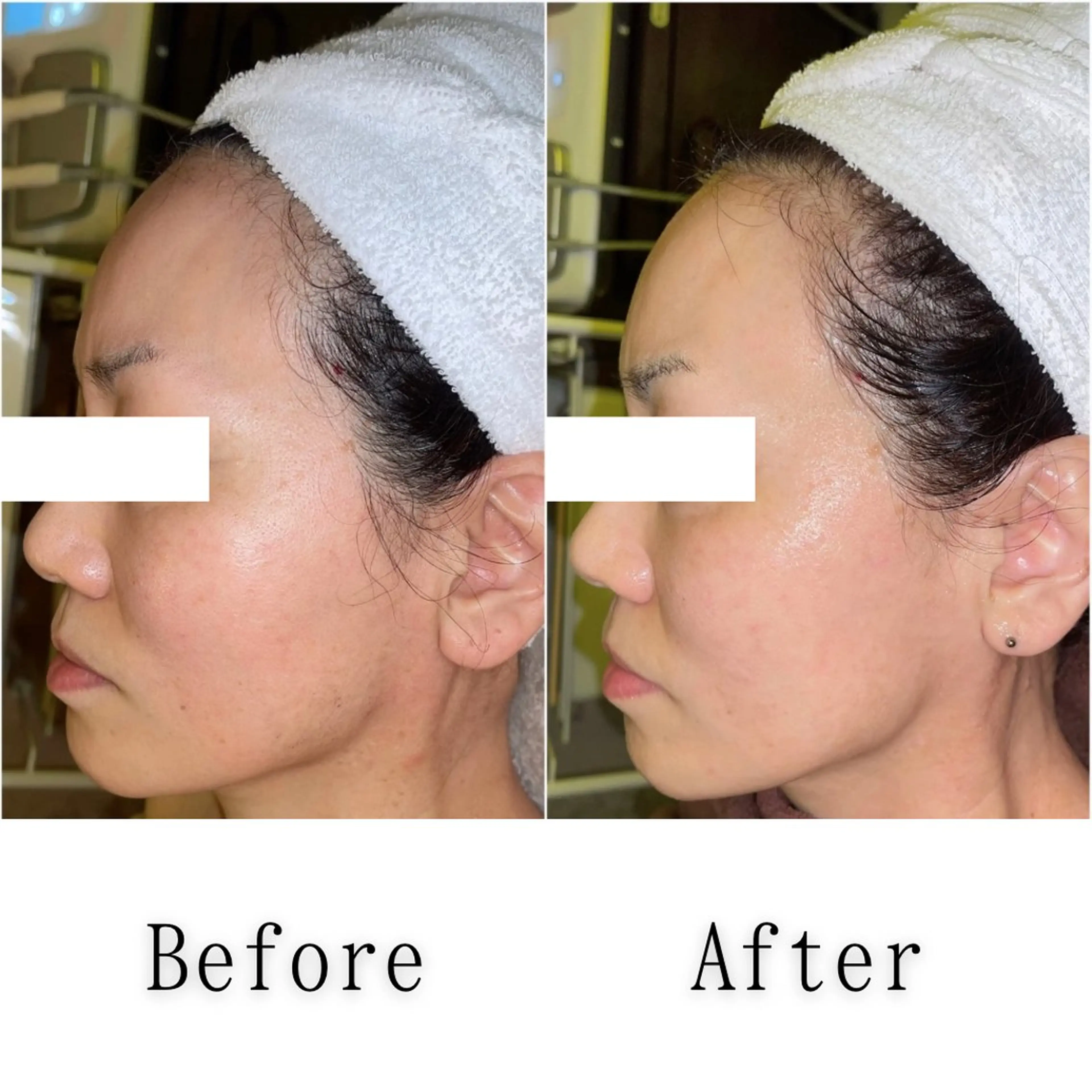 エステ SELF  BEAUTY gracia浦添店所属・gracia 浦添店のその他イメージ