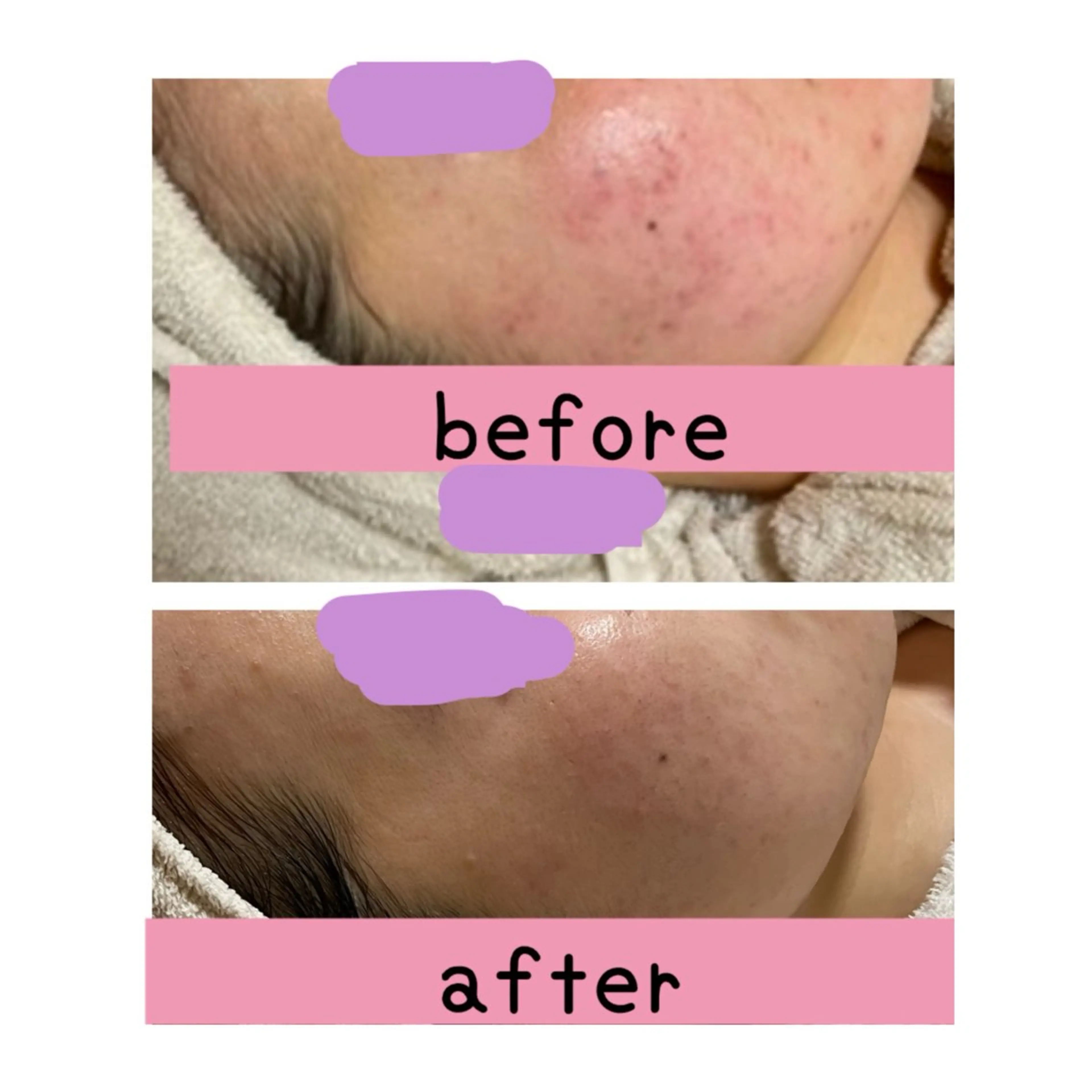 エステ 毛穴・リンパ・肌ケア サロン スリールのエステ・リラクイメージ