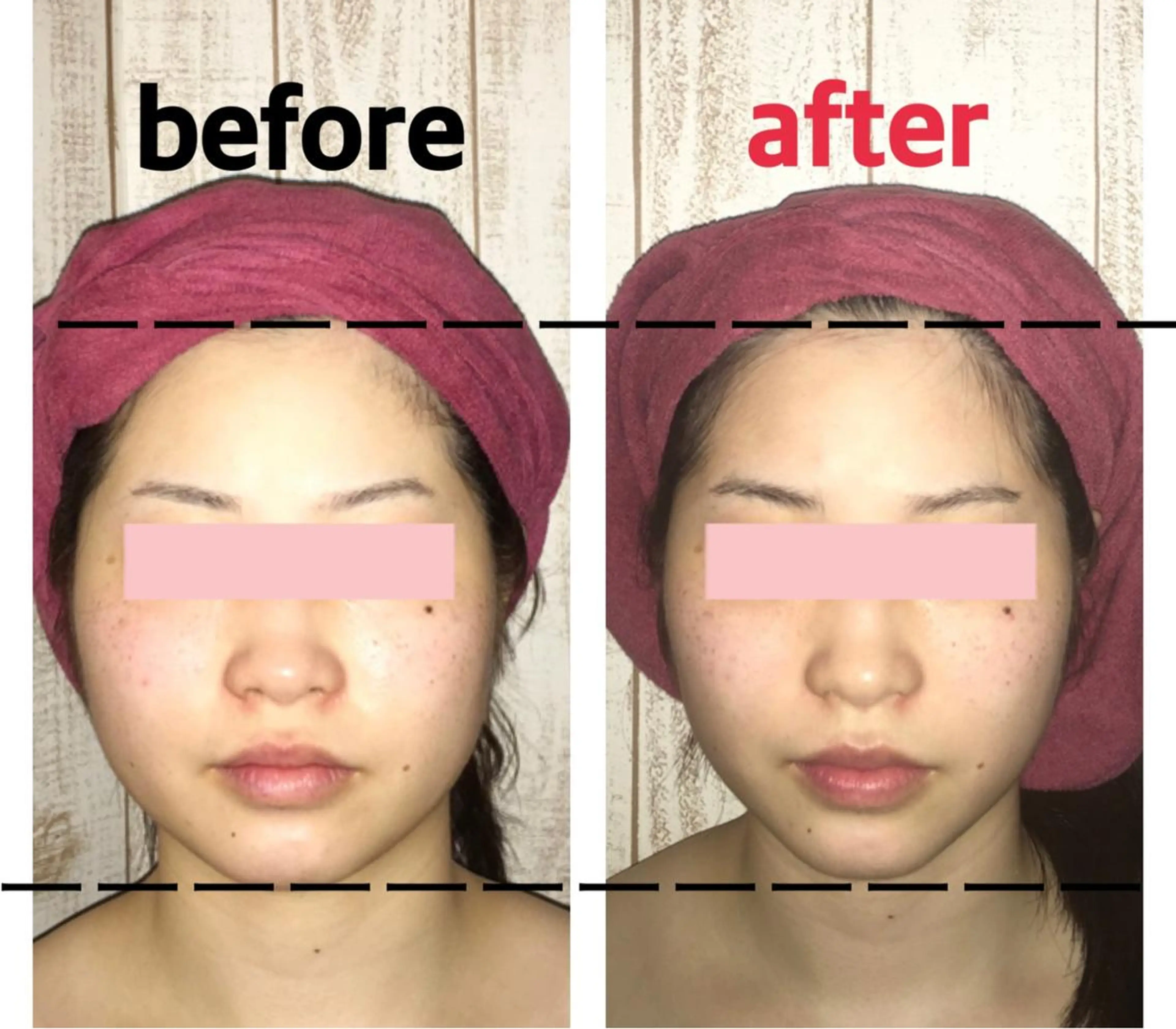 小顔プランナー辰巳 愛美のエステ・リラクイメージ