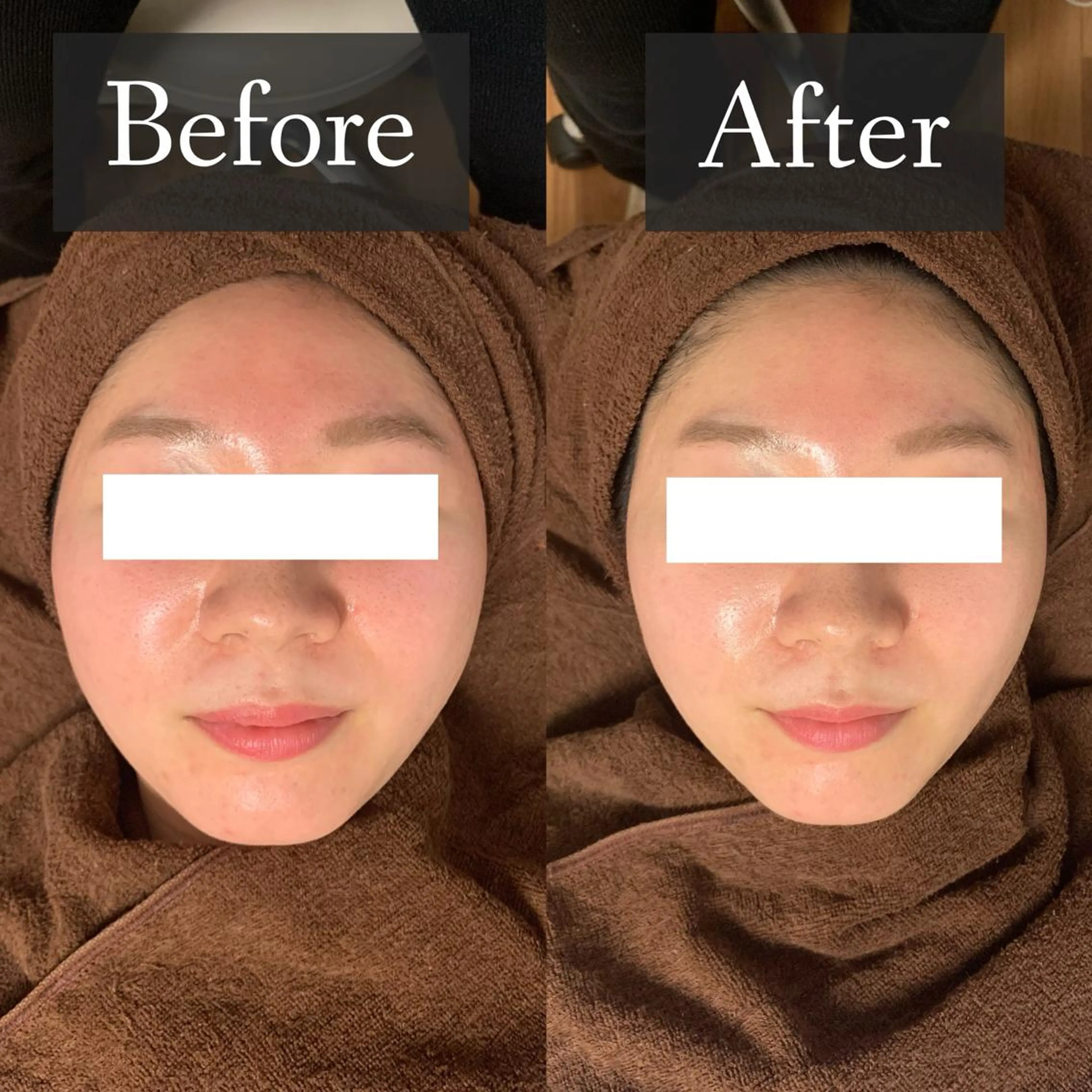 脱毛専門サロン BELFINE恵比寿のエステ・リラクイメージ