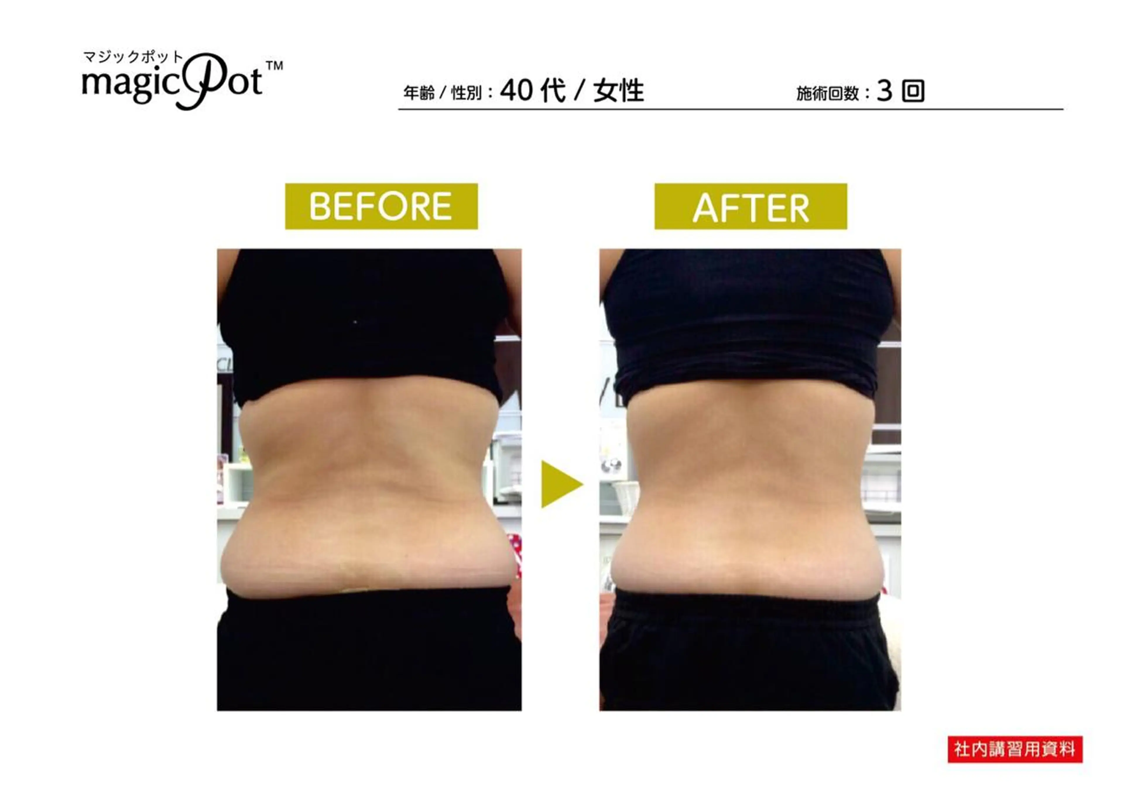 エステ リラク 心斎橋痩身ダイエット 韓国.美容鍼.小顔のエステ・リラクイメージ