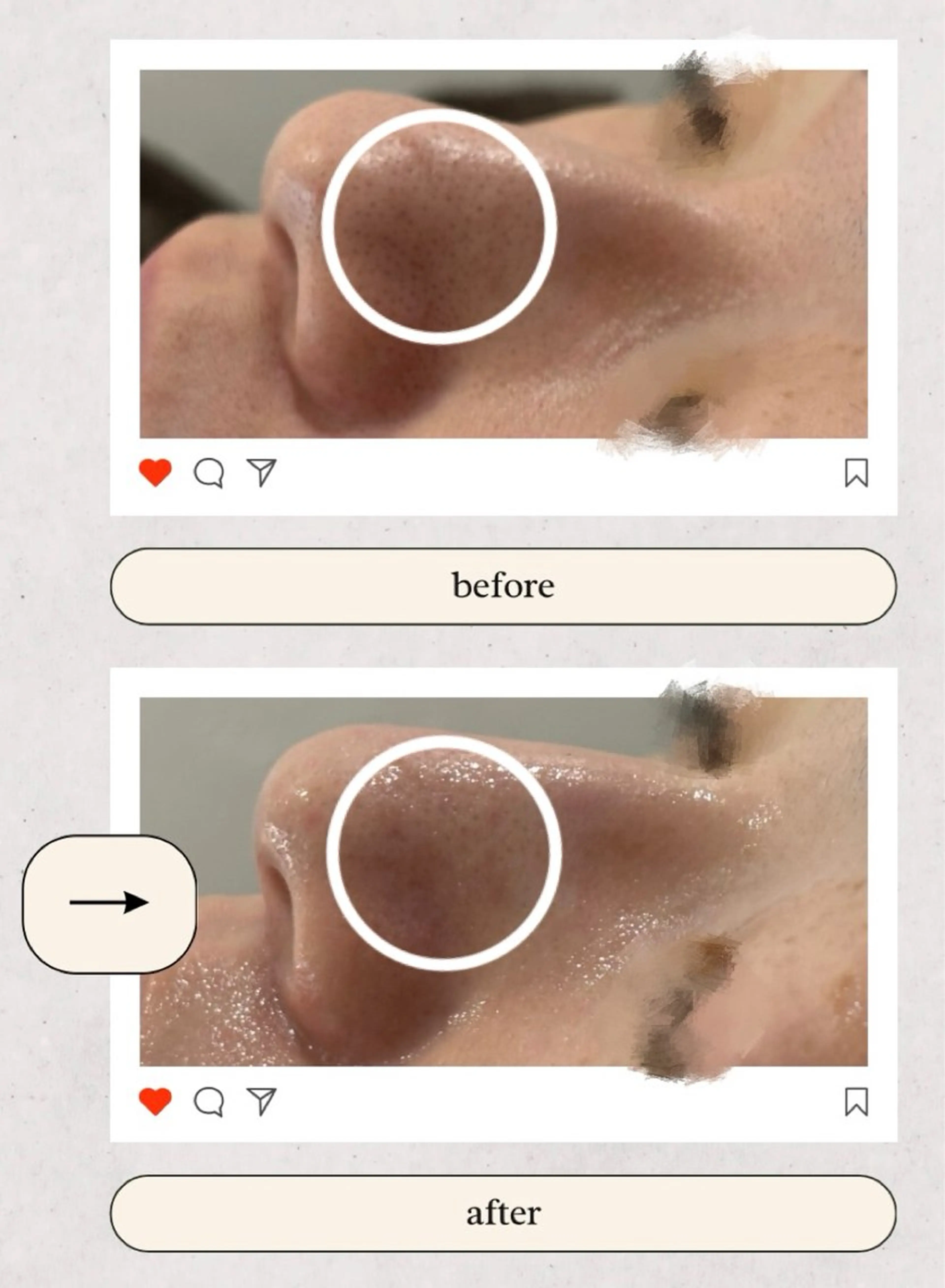 AY'S所属・倉敷/玉島/毛穴洗浄 古川碧のエステ・リラクイメージ