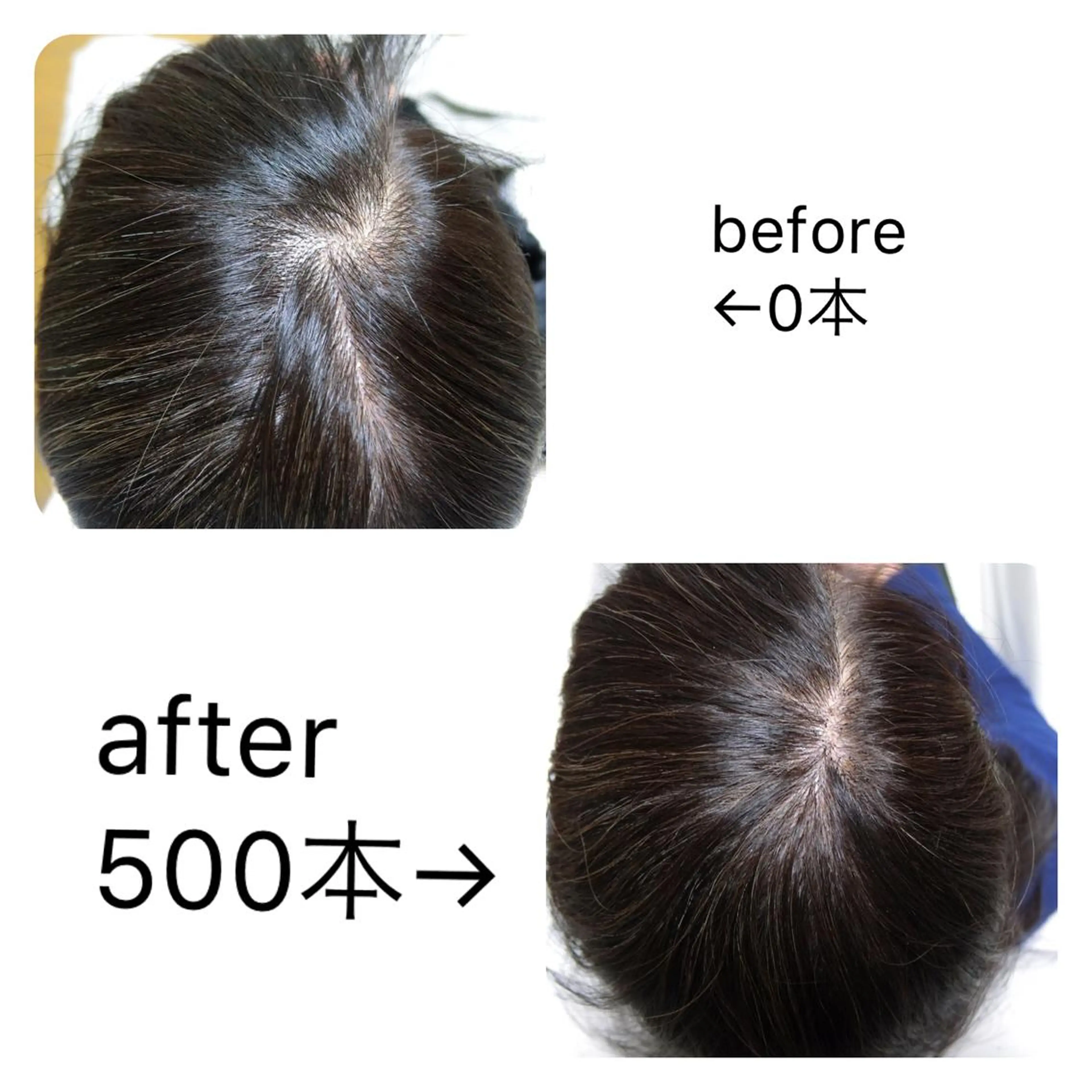 痛ネイル/ワンホン/ フィルイン/長さだしのネイルデザイン