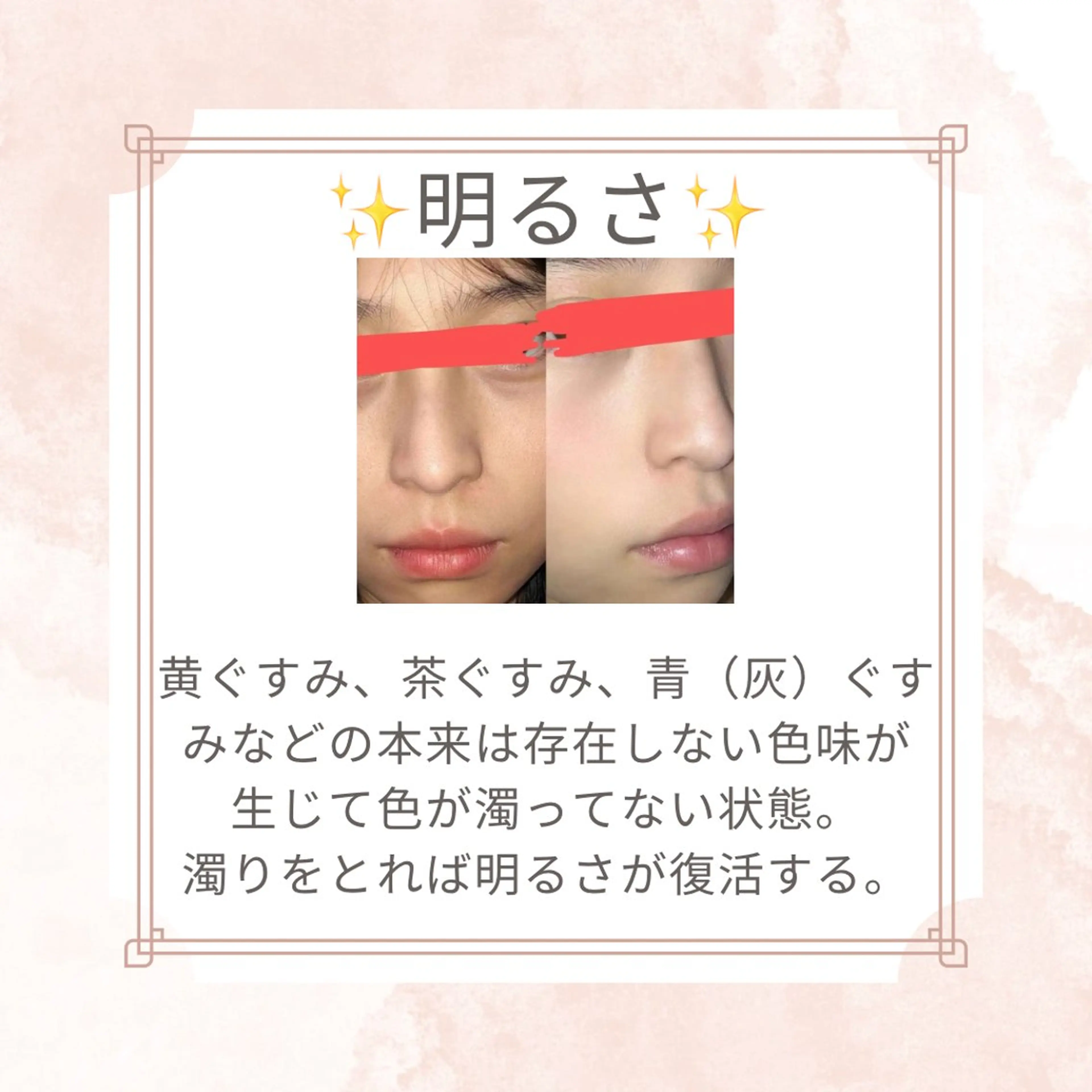 エステ リラク 愛維美水光美肌専門店所属・愛維美水光美肌専門店 メンズレディースokのエステ・リラクイメージ