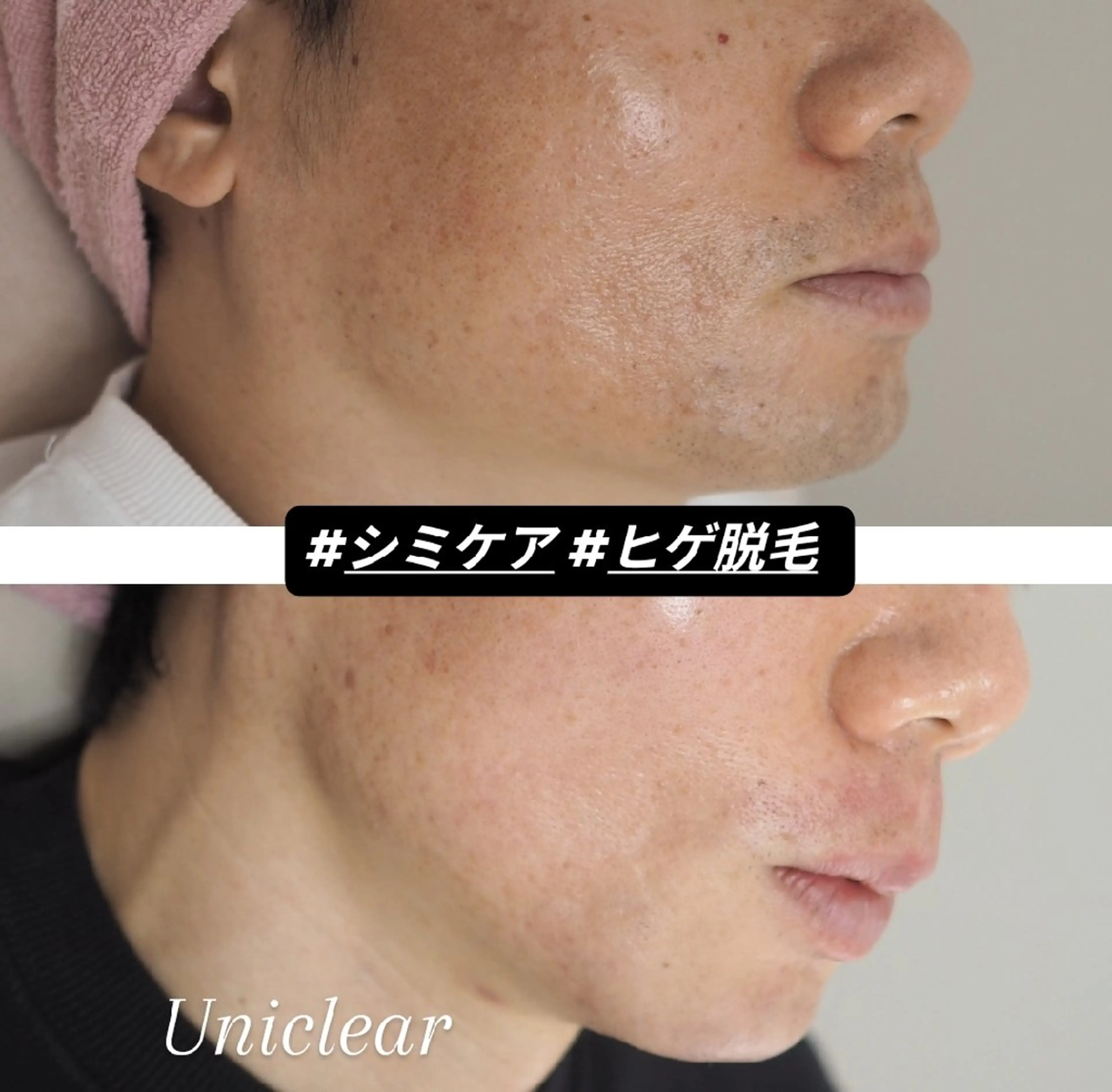 ユニセックスエステサロンUniclear所属・痩身&フェイシャル Uniclearのエステ・リラクイメージ