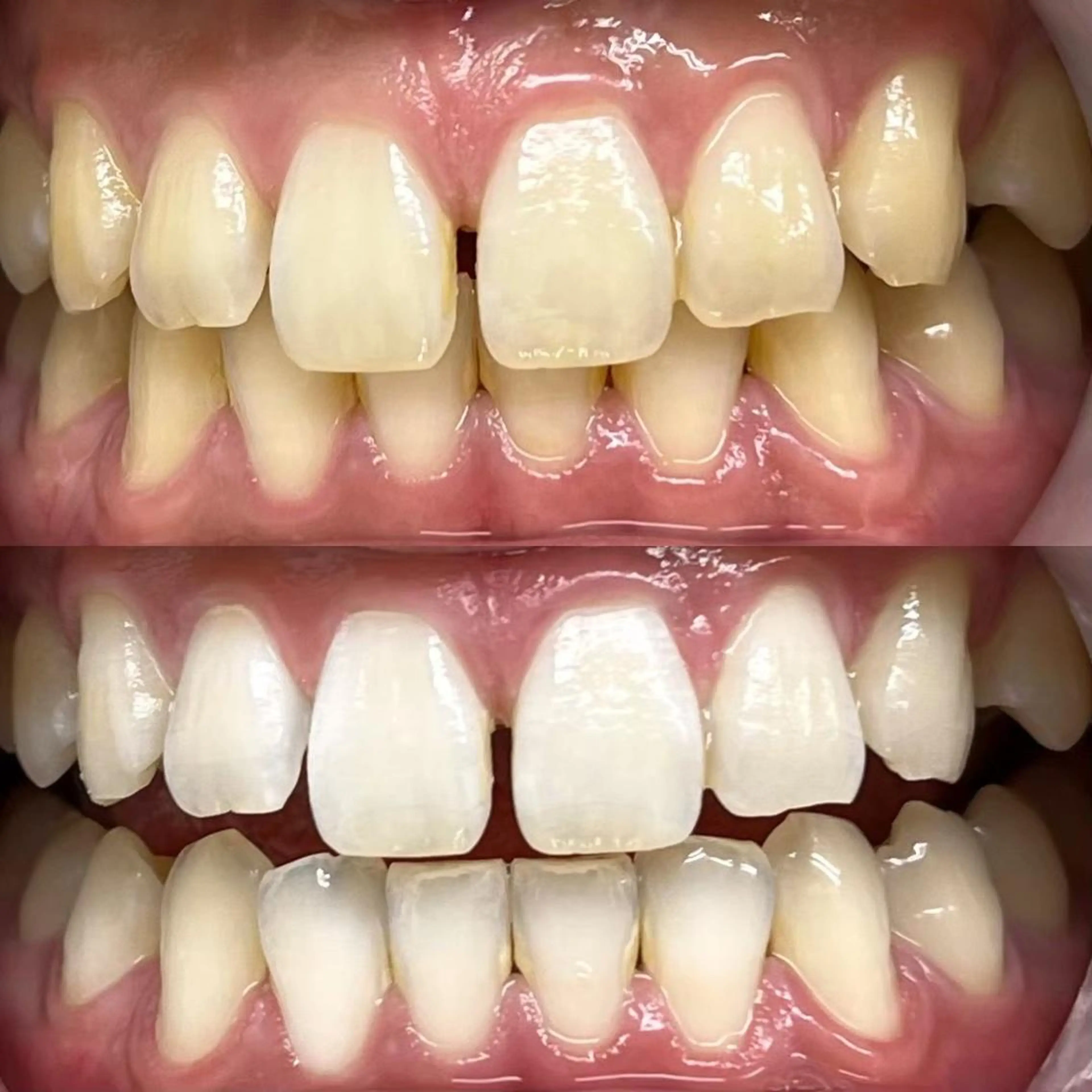 LBSホワイトニング 銀座店💎公式のその他イメージ