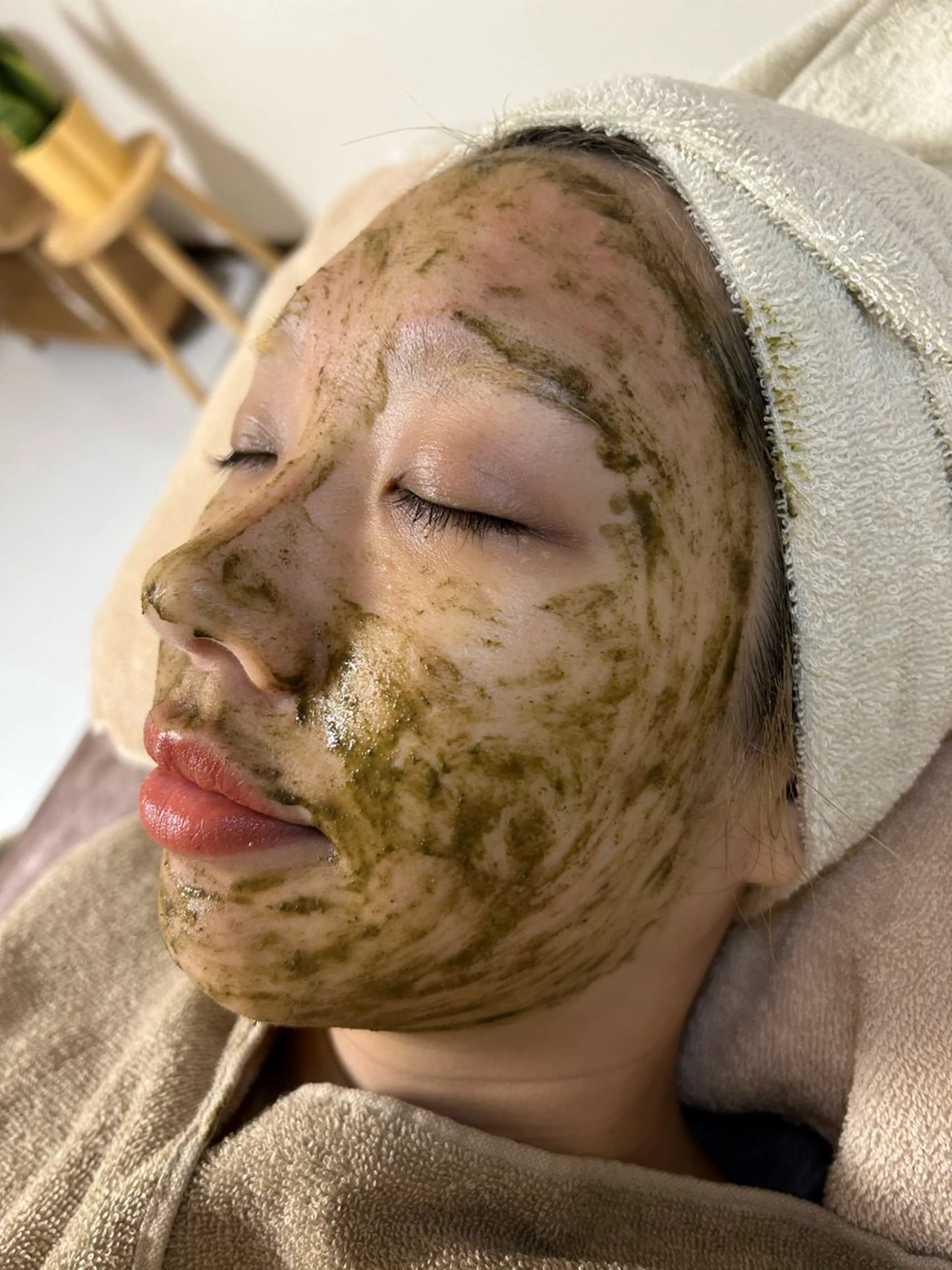 エステ eto.所属・肌質改善サロンeto ニキビ・ニキビ跡のエステ・リラクイメージ