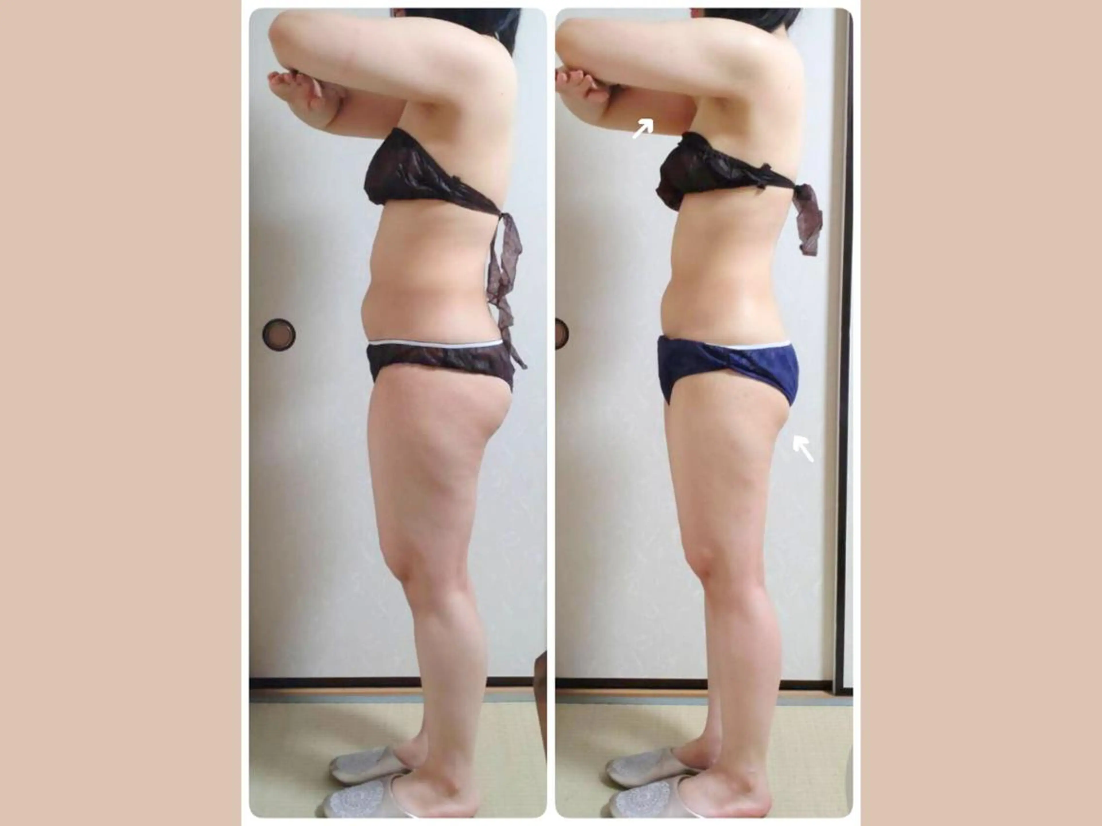 その他 痩身&小顔矯正専門店 Re:Livesのエステ・リラクイメージ