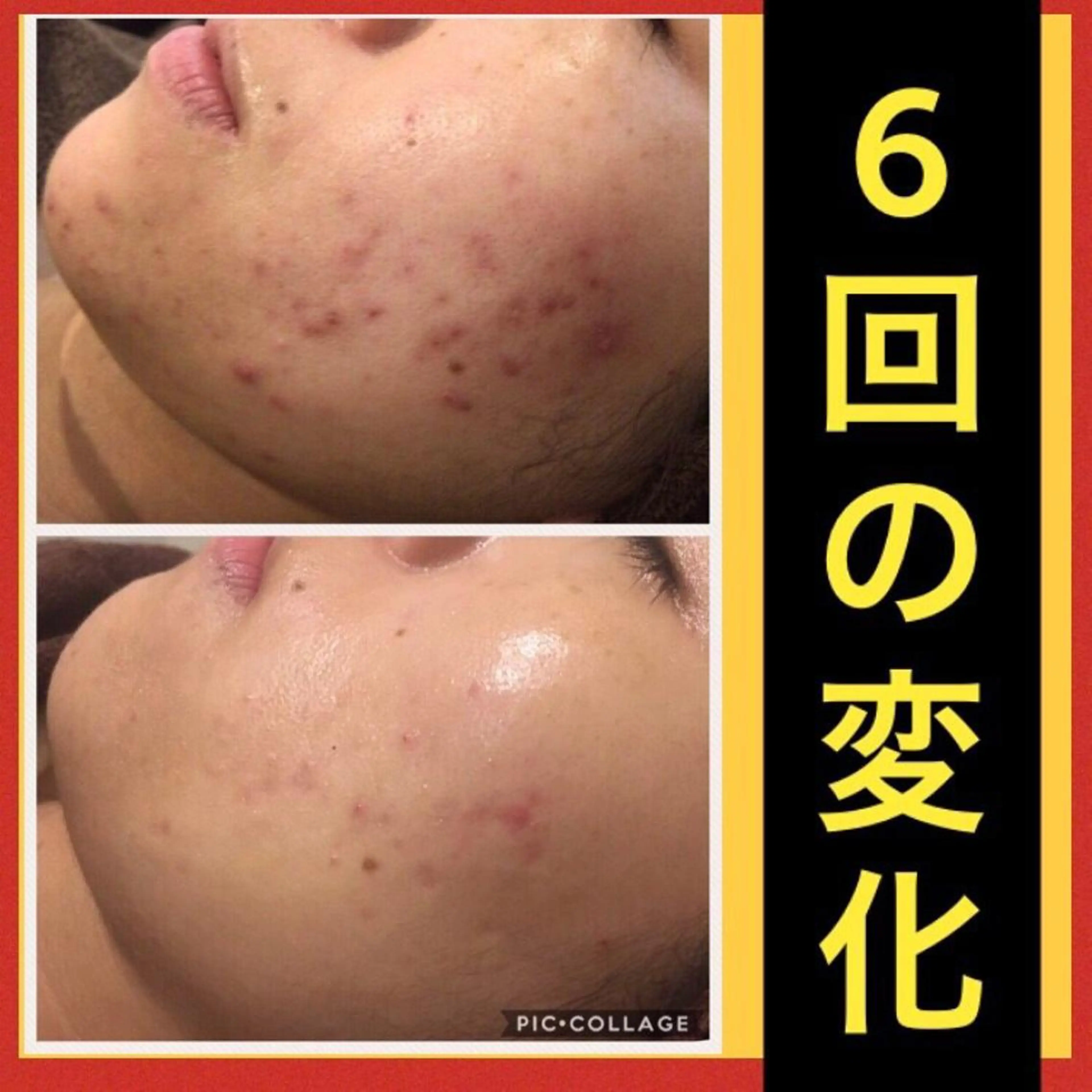 ショート カラー パーマ ヘアアレンジ メンズ キッズ ネイル マツエク・マツパ エステ リラク ニキビ・肌質改善専門 ♡人生が変わるサロンのエステ・リラクイメージ