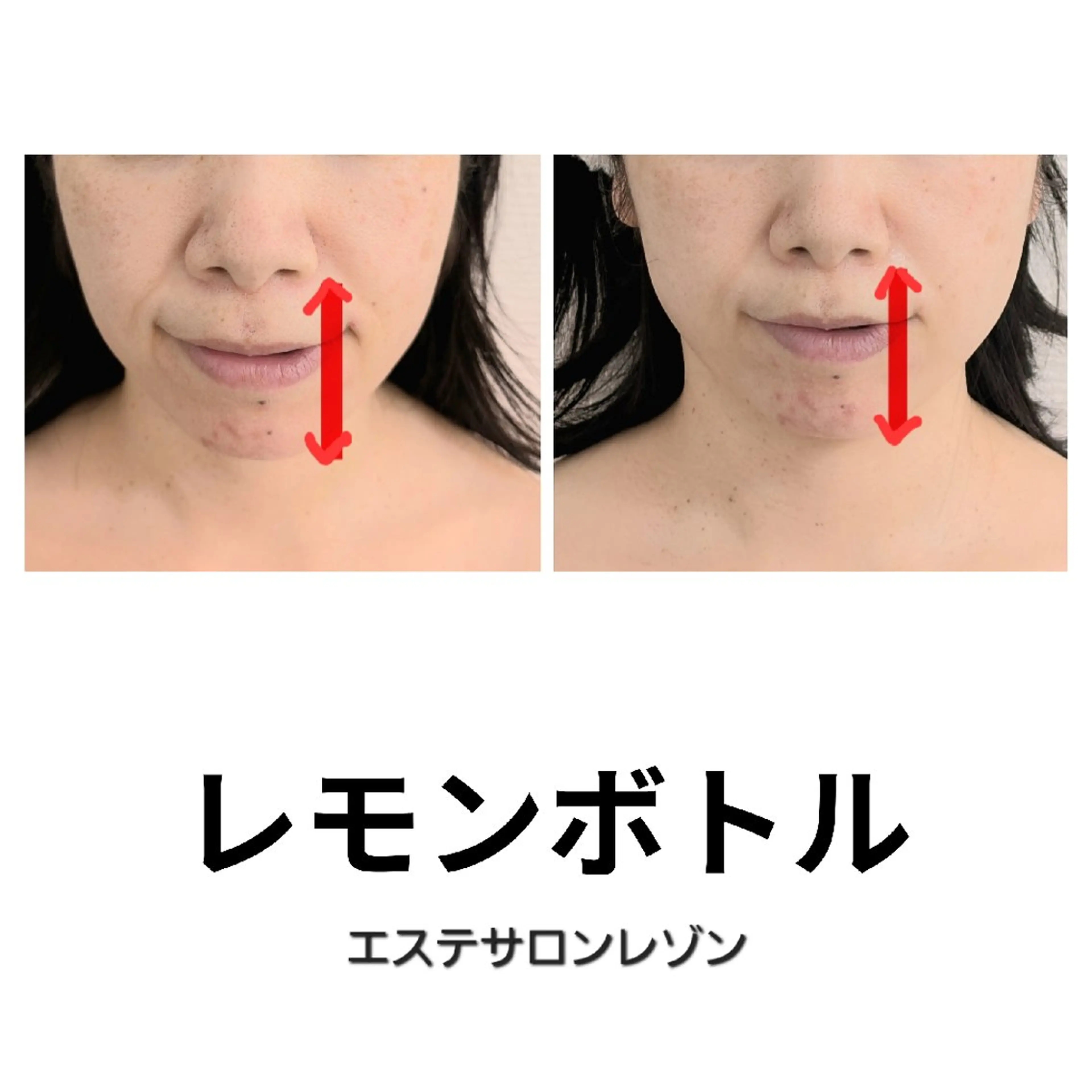 ニキビケア＆ニキビ跡 レゾン京橋店　のエステ・リラクイメージ