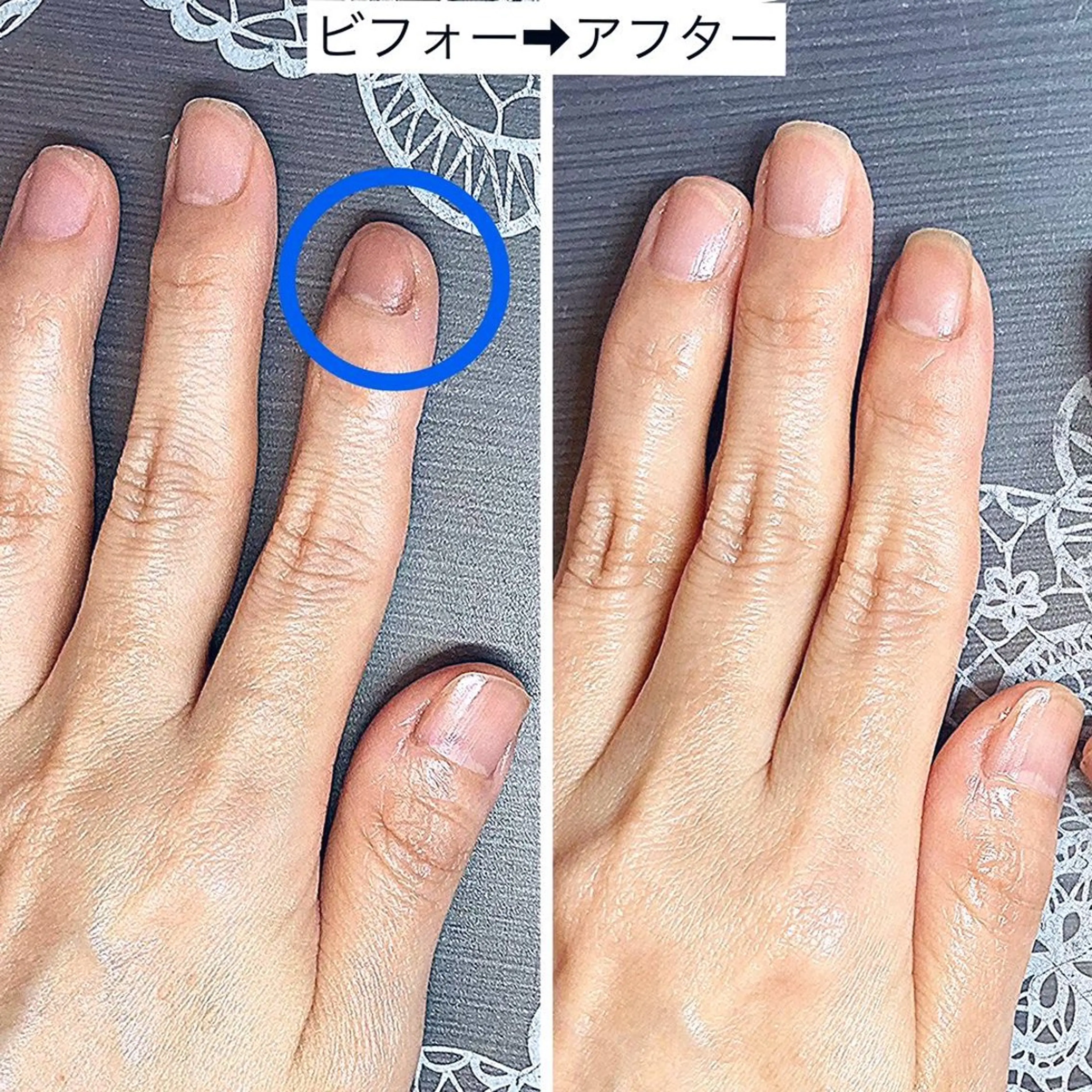 初回お悩み相談、ホームケアの方法なども丁寧にお伝えします。使いやすいケア用品を選ぶ事が自爪育成のコツ⭐️メンズOKの写真