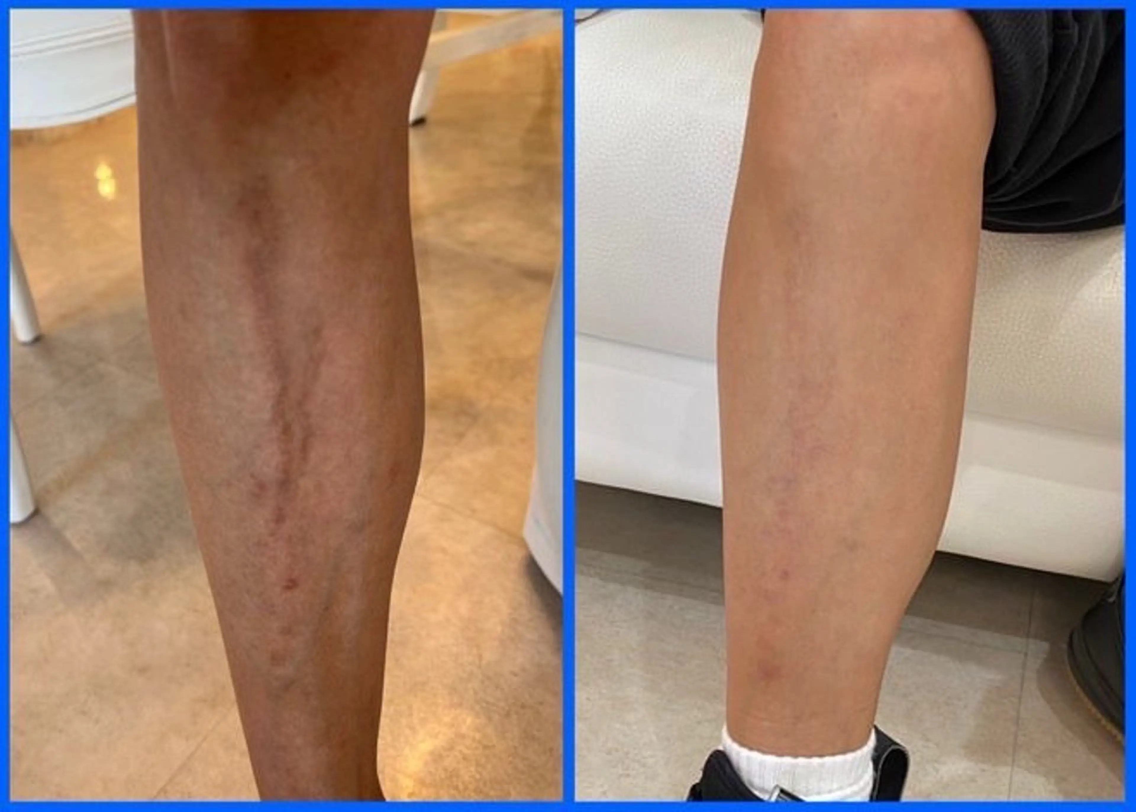 メンズ private salon Aola所属・プライベートサロン アオラのネイルデザイン