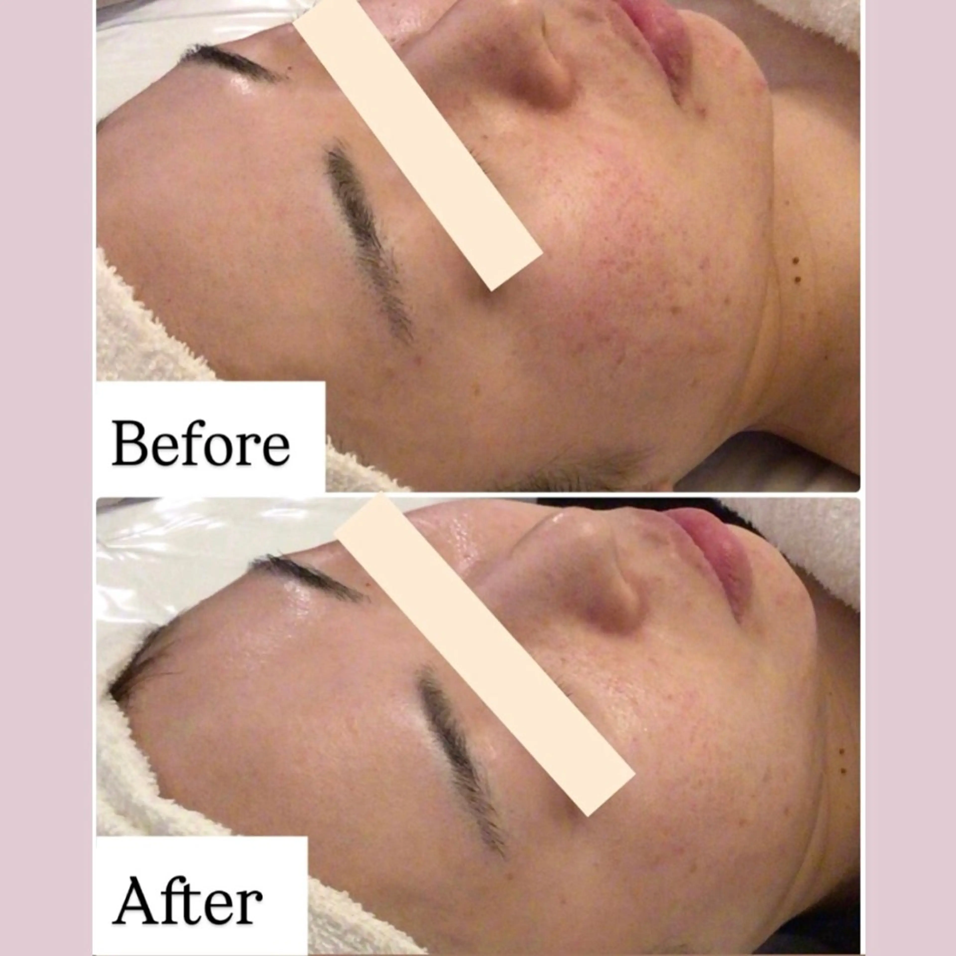 リフトアップ小顔 専門のエステ・リラクイメージ