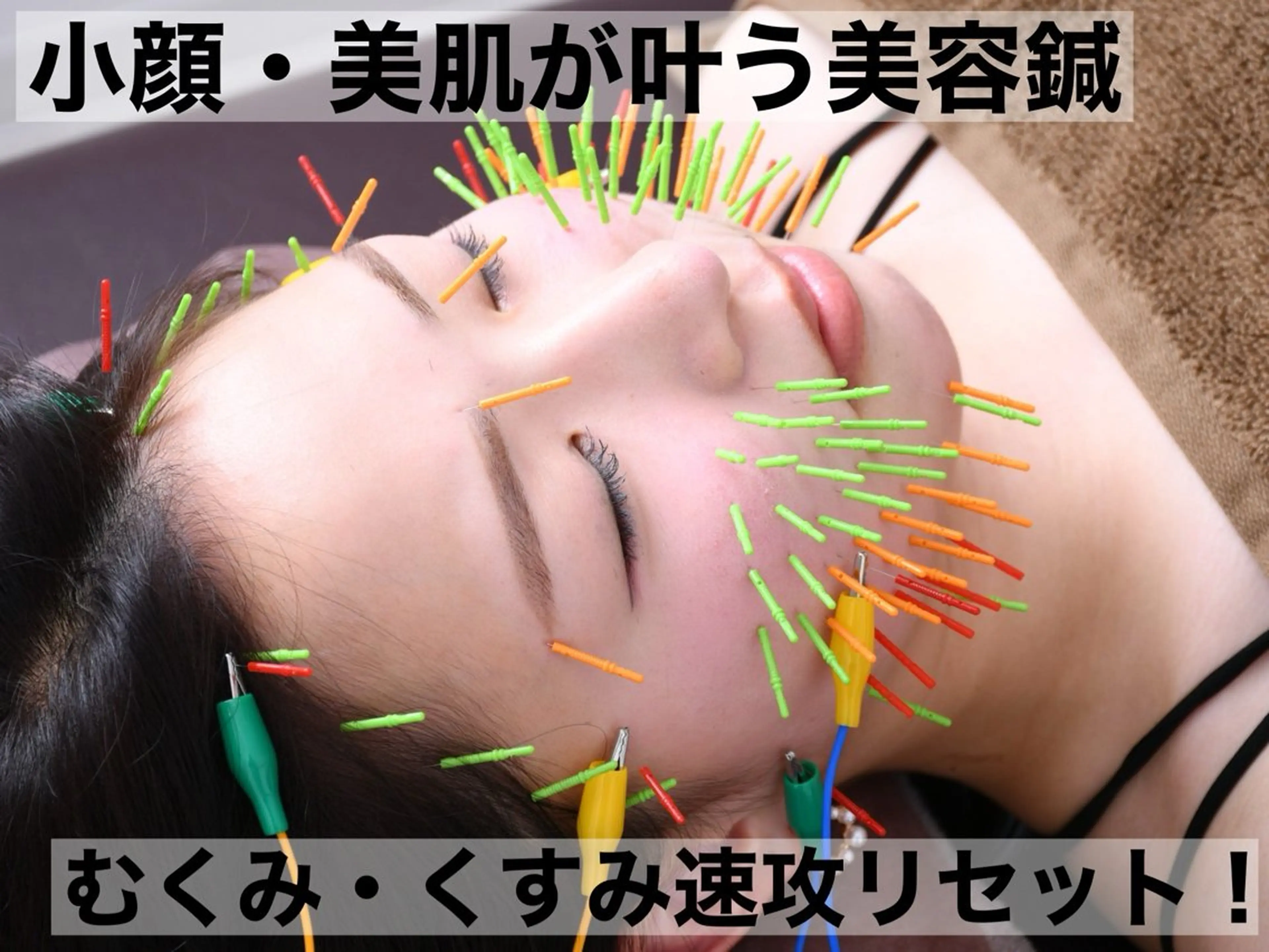 エステ リラク 美容鍼灸Solana所属・肌質改善×美容鍼 ゆいのエステ・リラクイメージ