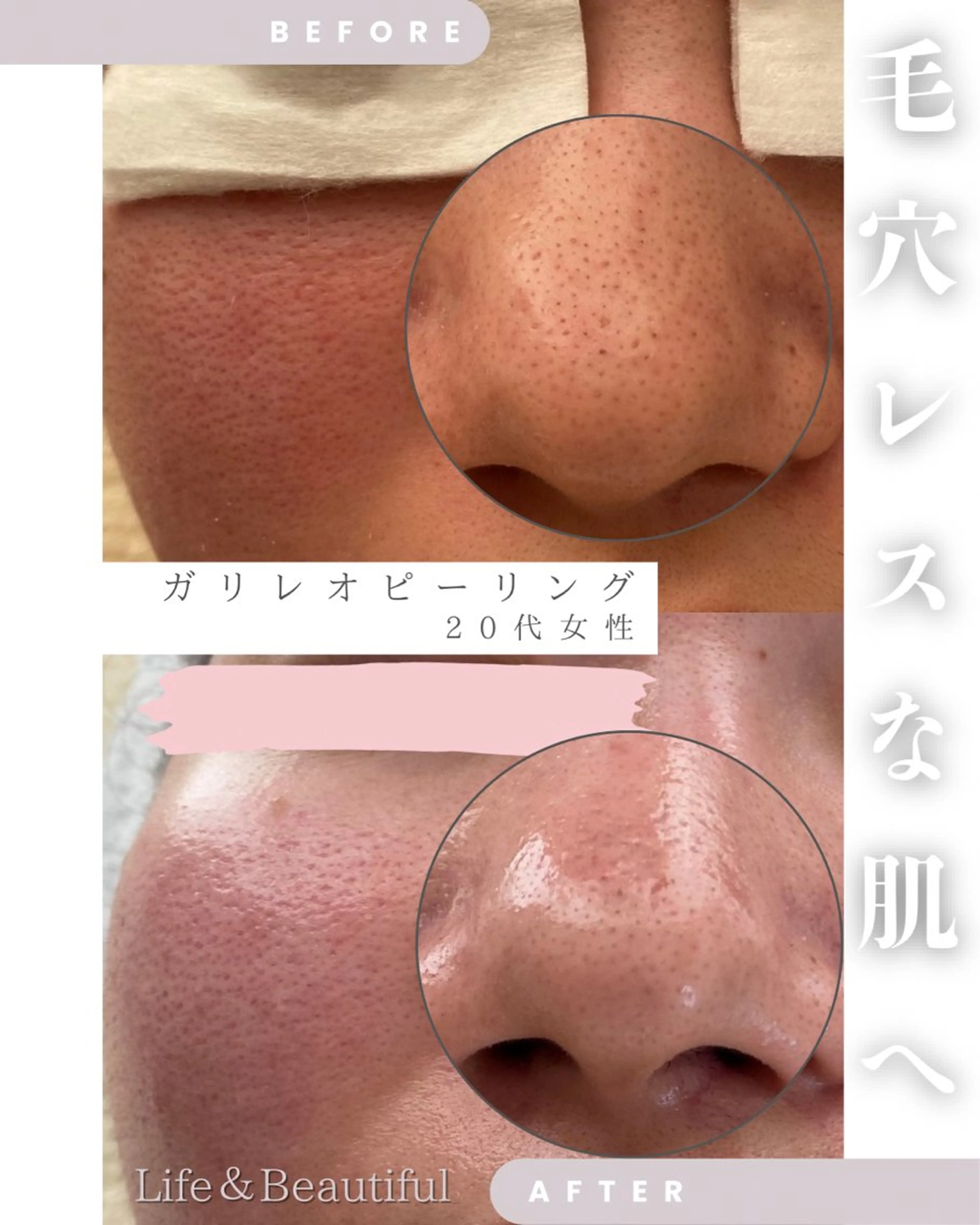 Life＆ Beautifulのエステ・リラクイメージ