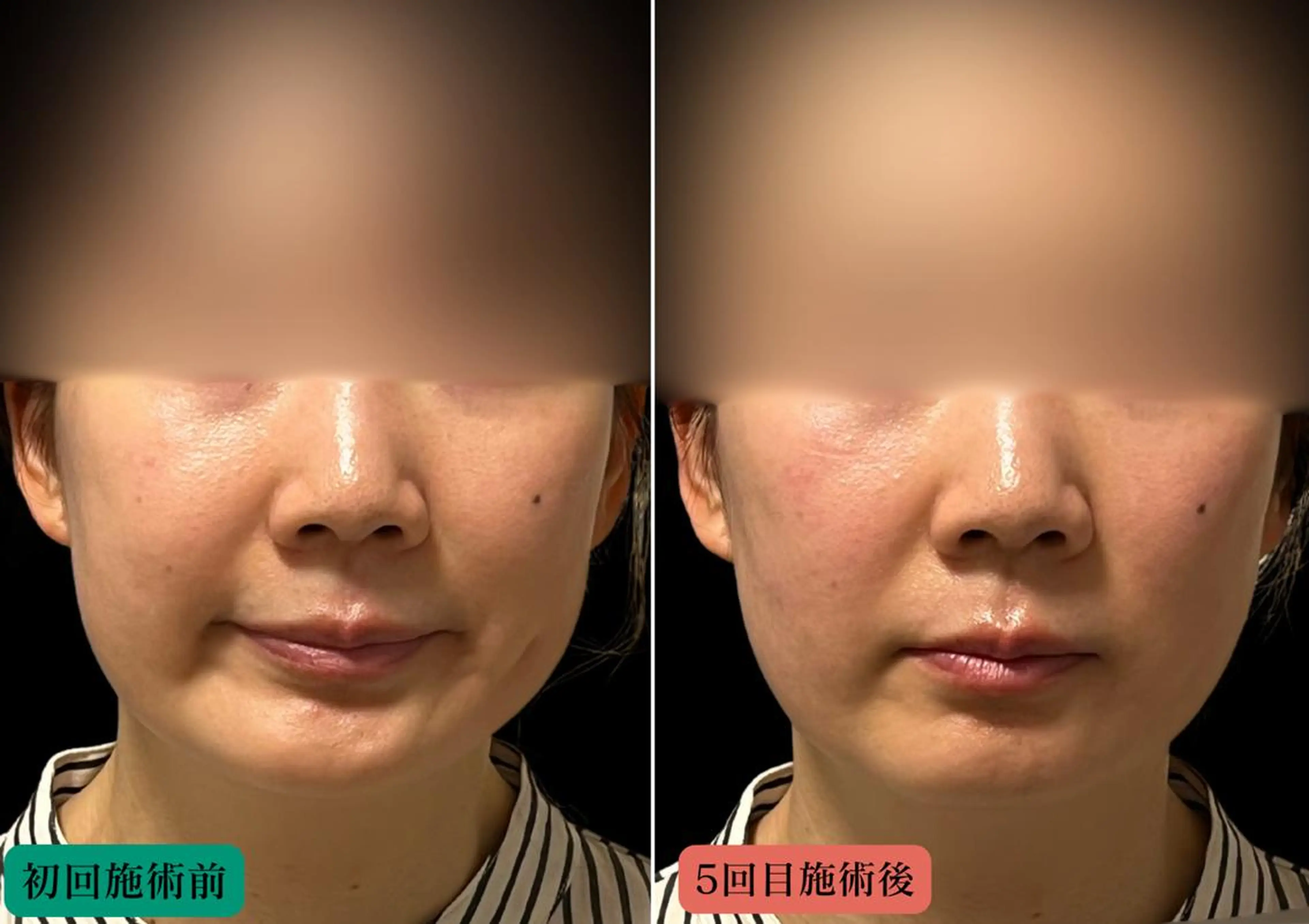 エステ リラク 美容とカラダの鍼灸 サロン やなけんのエステ・リラクイメージ