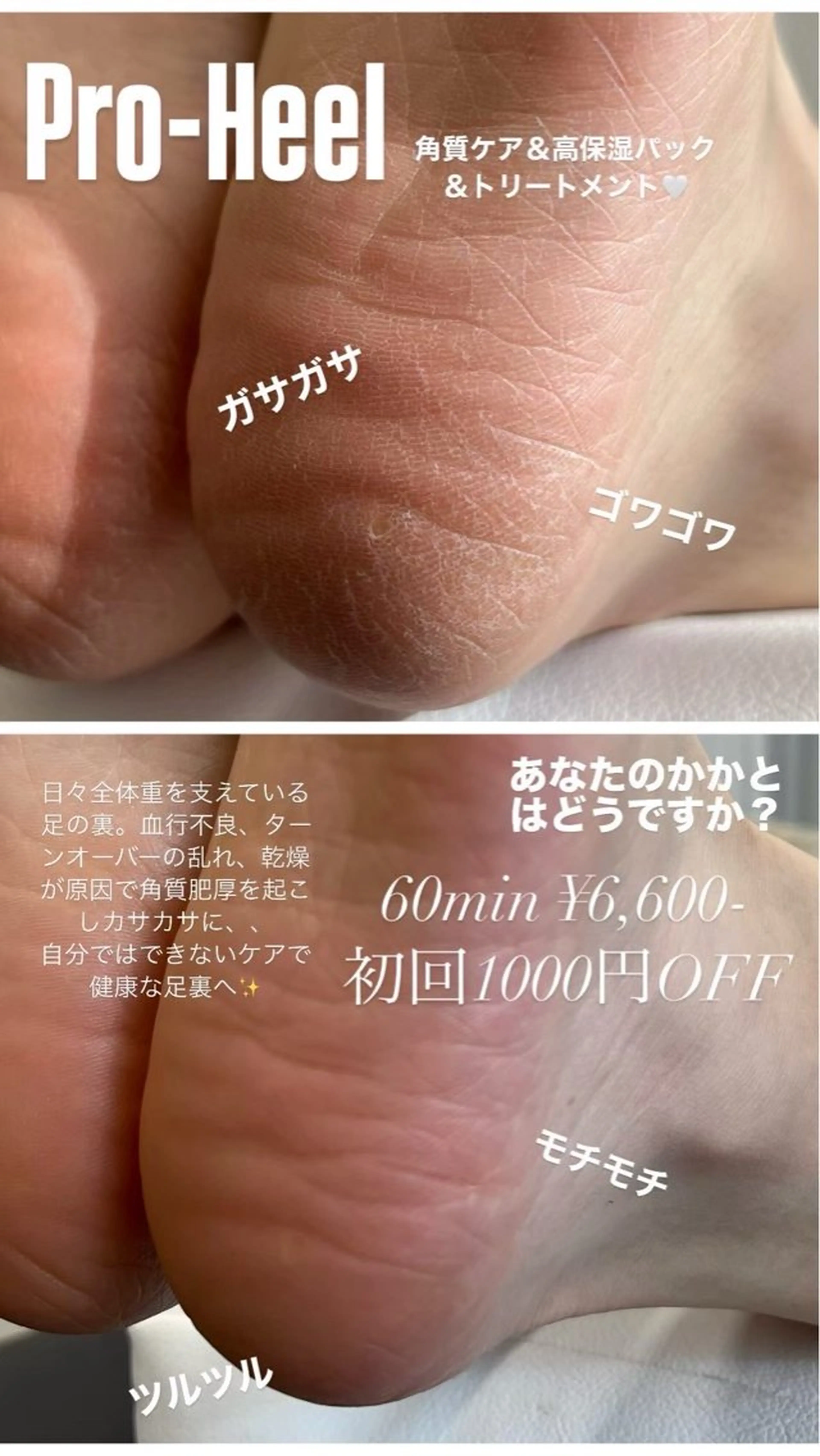 プロヒール(角質ケア→高保湿パック→膝下＆足裏フットトリートメント)の写真