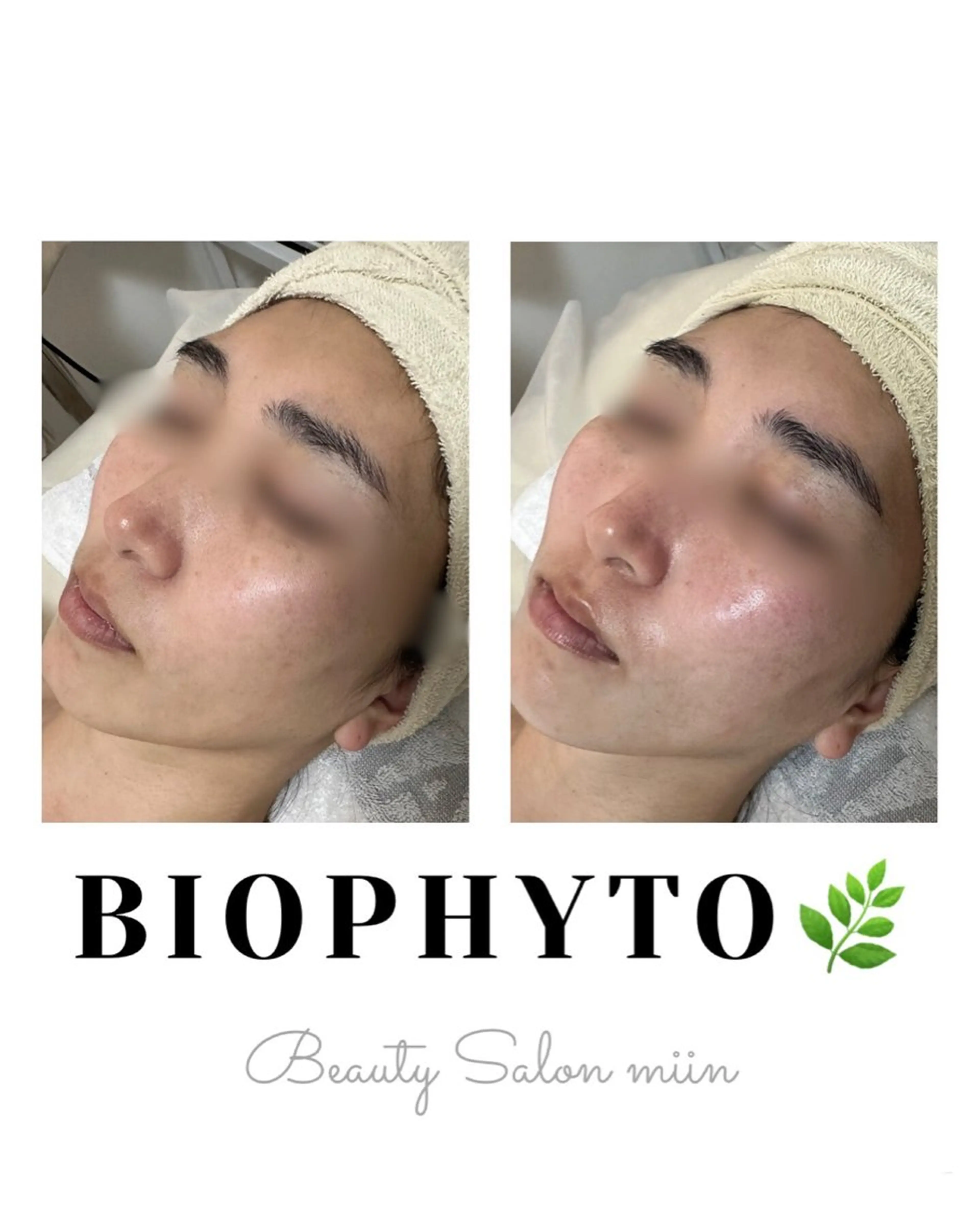 エステ 韓国肌管理 白玉肌管理®︎のエステ・リラクイメージ