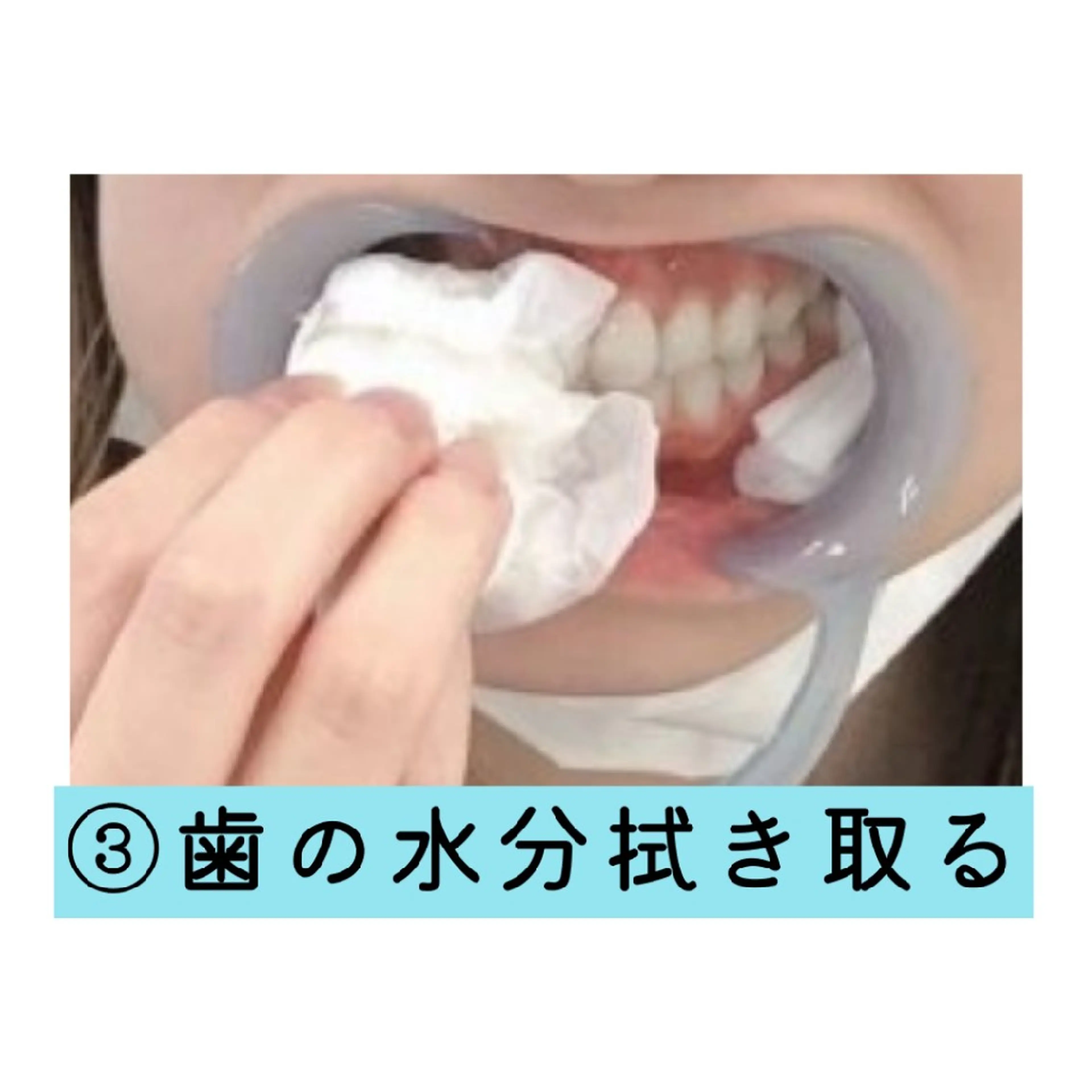 ホワイトニングサロン ネージュ(女性専用)のその他イメージ