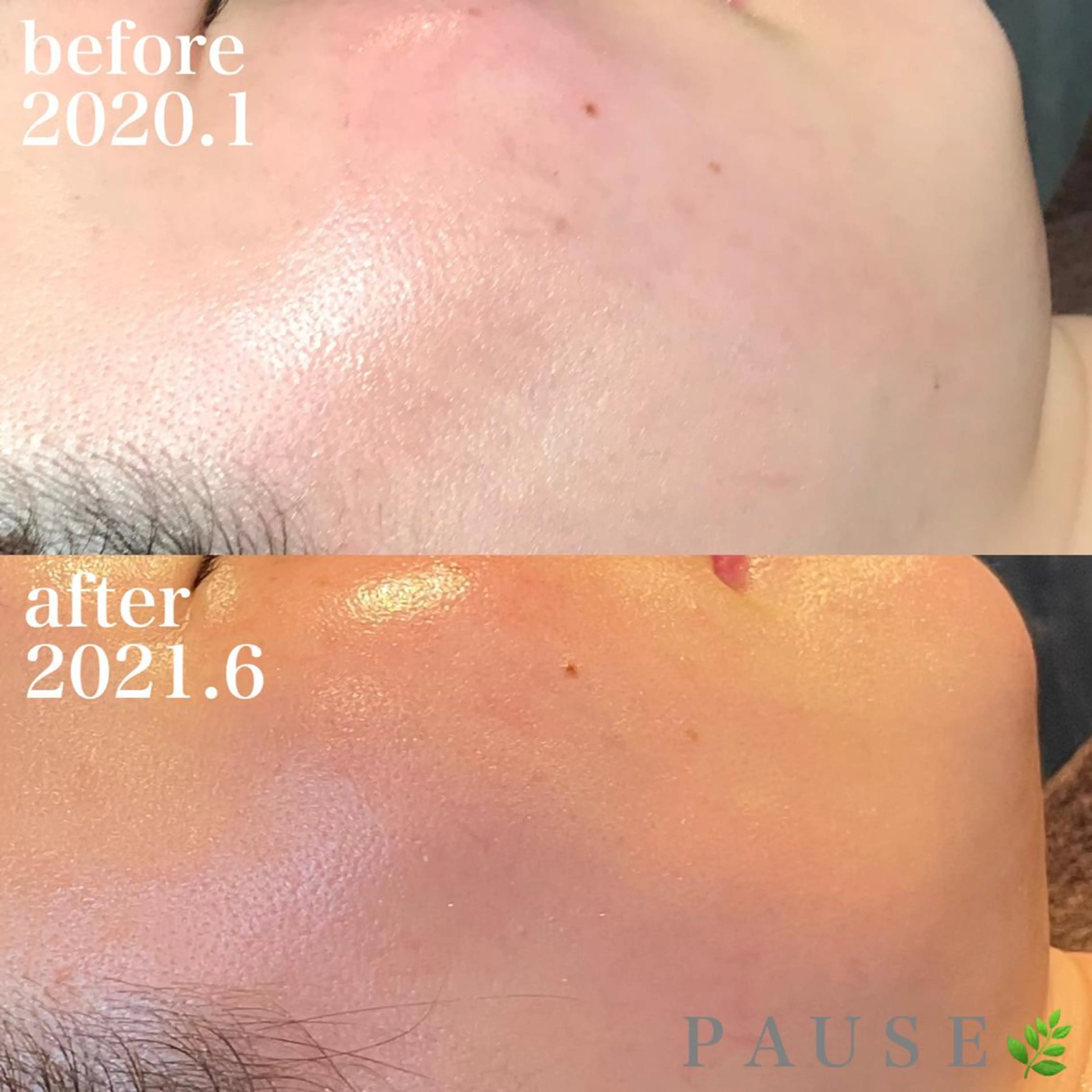 エステ 浜野 恵美のエステ・リラクイメージ