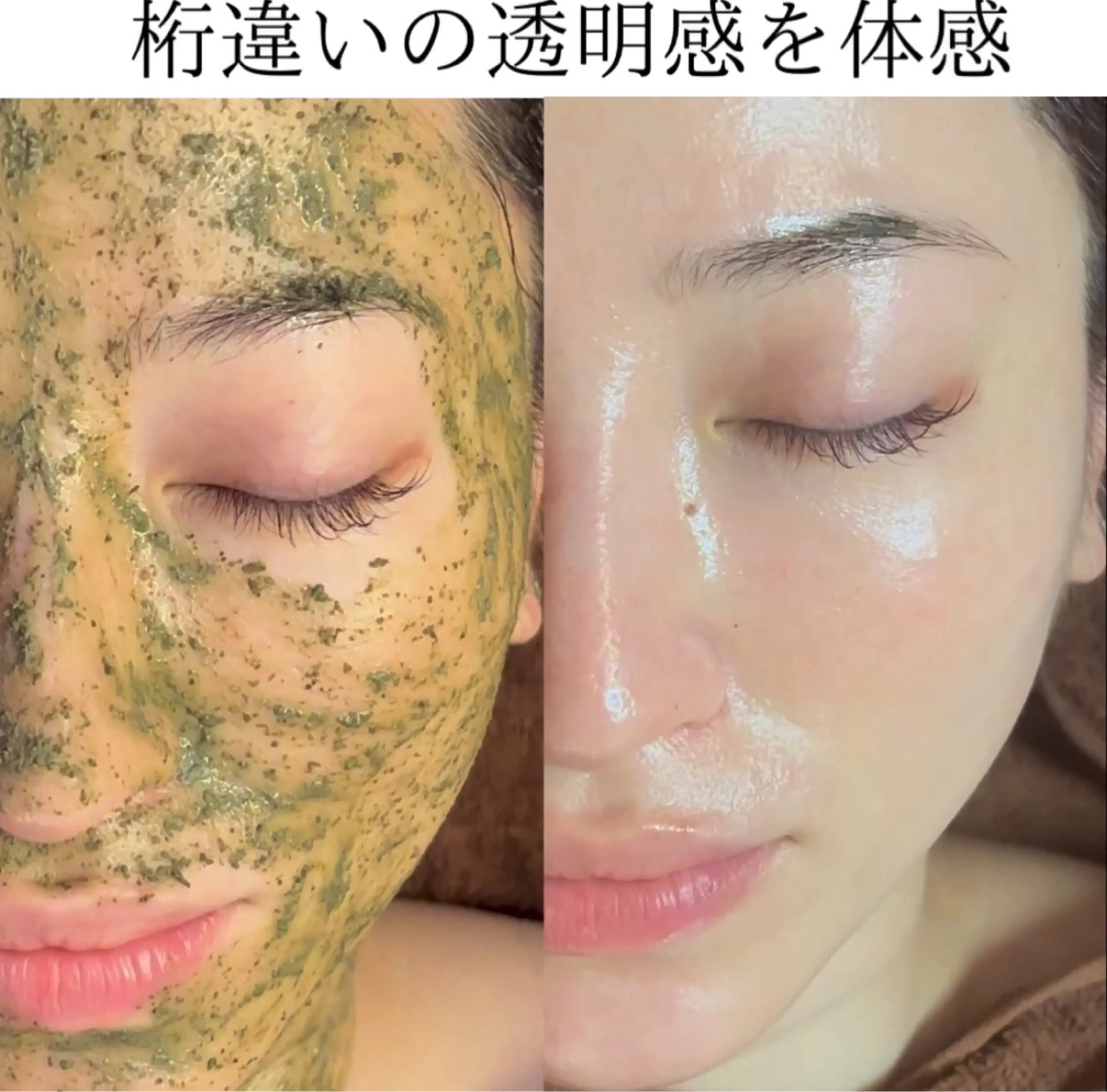 【リピ率No.1】ハーブピーリングで肌質改善＋専用美容液導入の写真