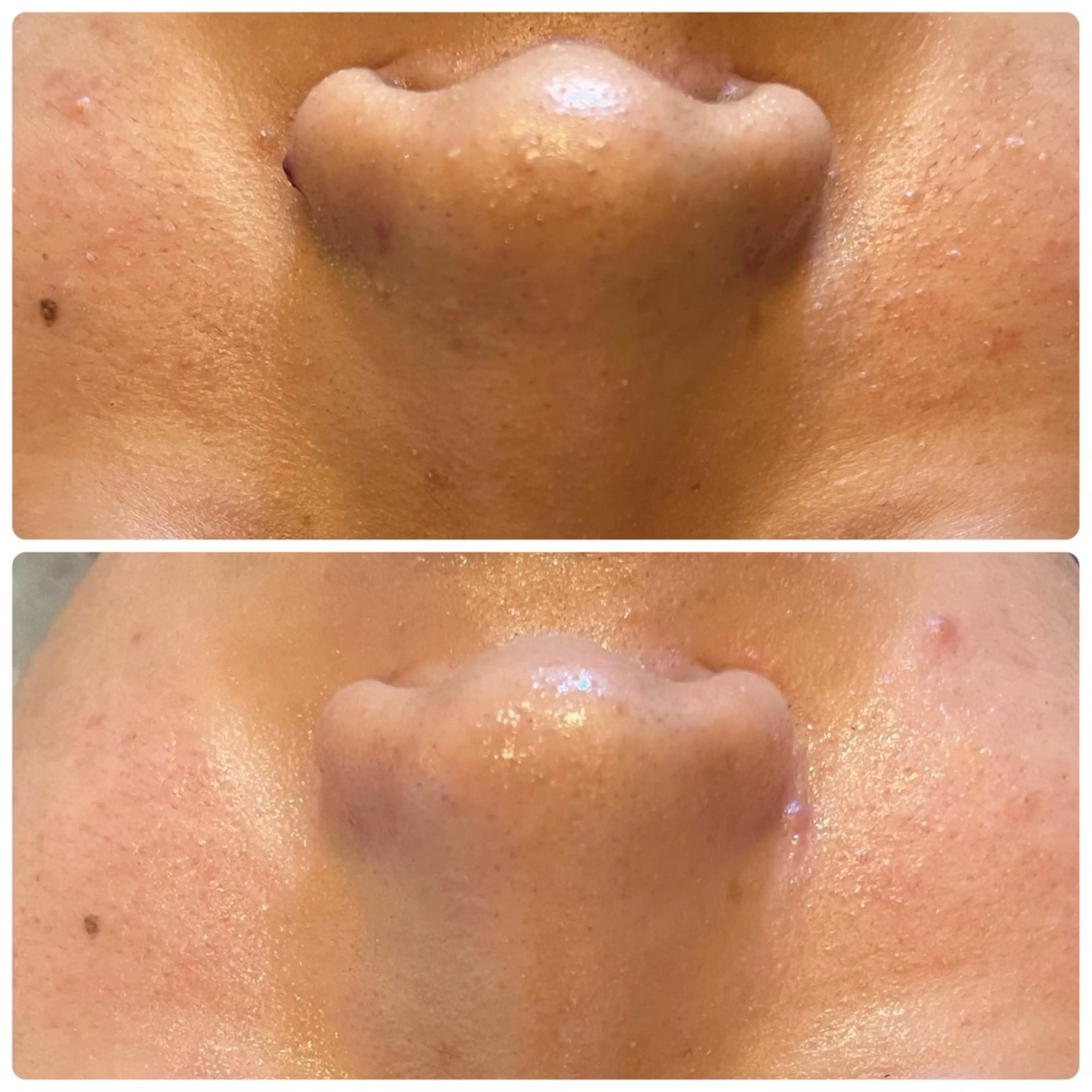 エステ yellow.所属・yellow💛【 脱毛&フェイシャル】のエステ・リラクイメージ