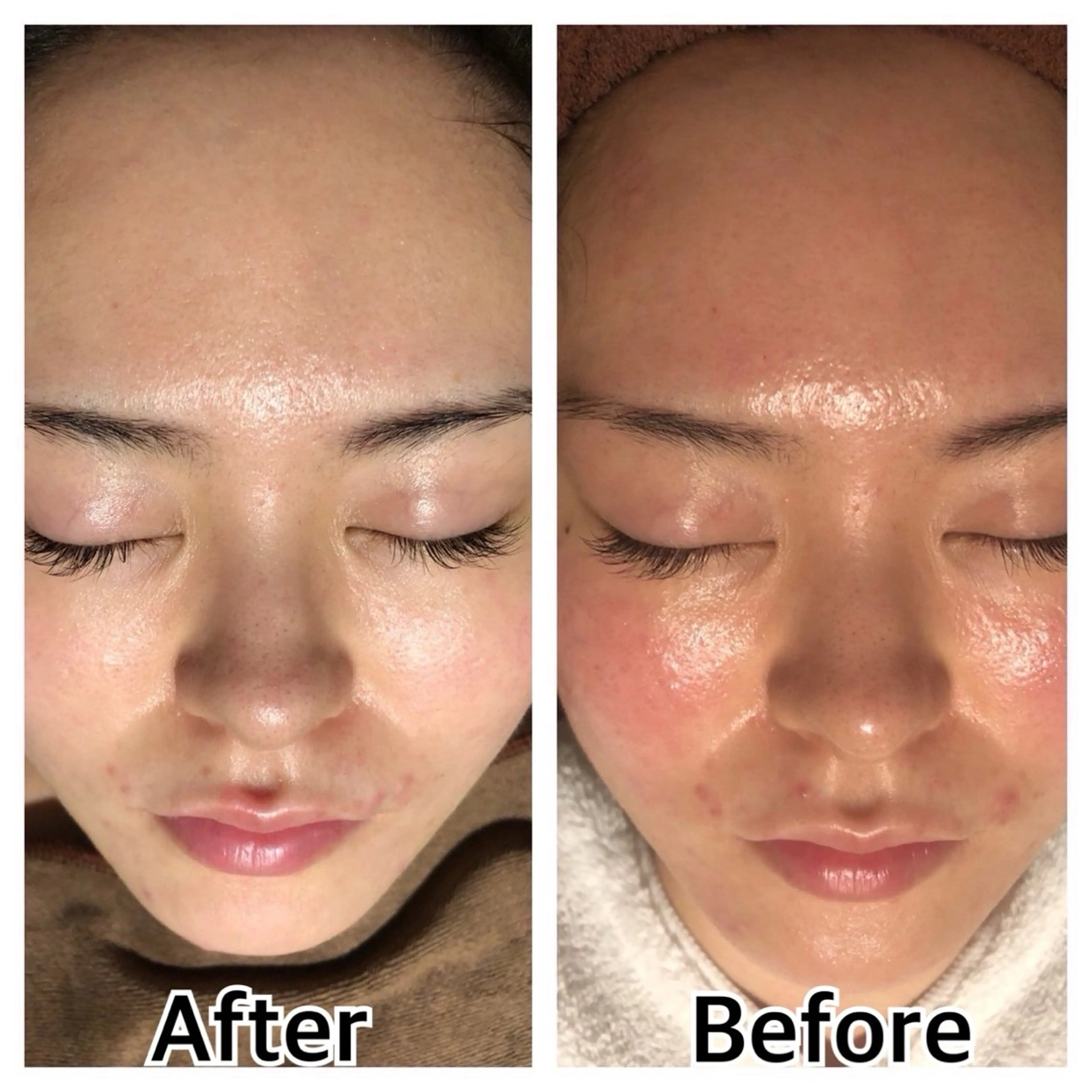 林 陽向のエステ・リラクイメージ